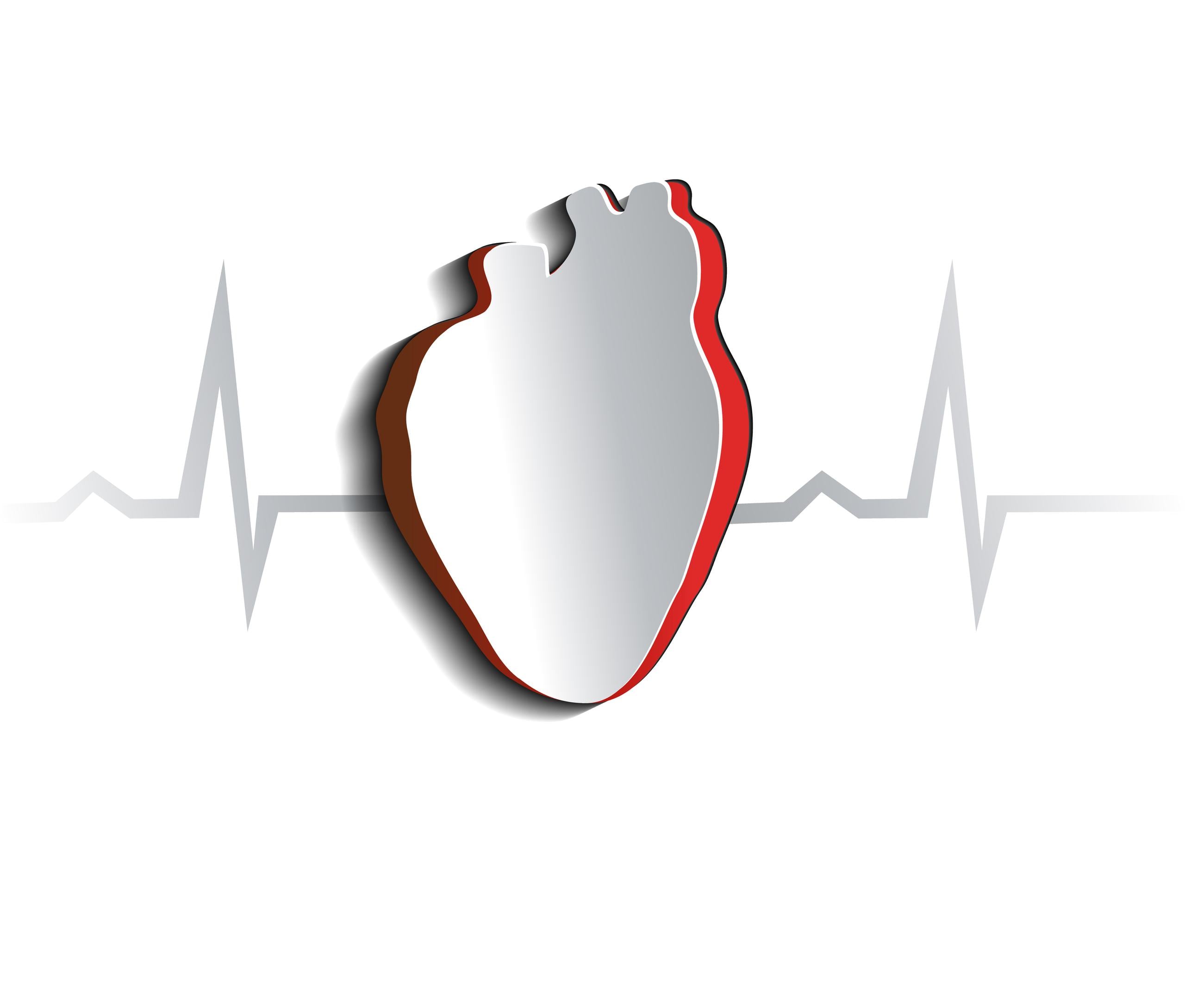 Las arritmias son unas alteraciones en el funcionamiento de la red eléctrica del corazón que modifican el ritmo cardíaco y tienen repercusión en la función de bombeo de este órgano, disminuyendo su eficacia.