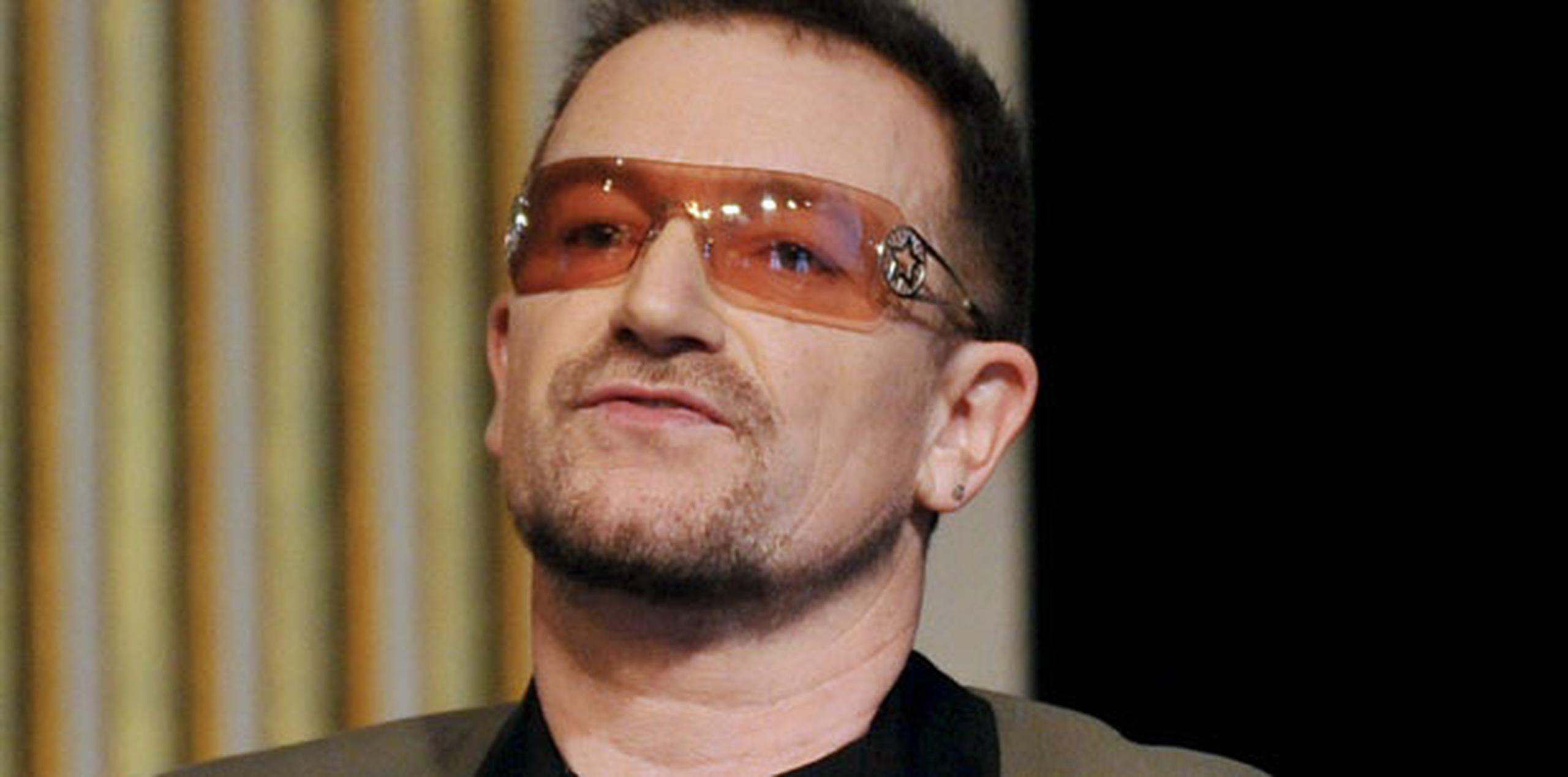 Bono se rompió el hombro en tres pedazos; su húmero izquierdo quedó destrozado; la parte superior del brazo se quebró en seis pedazos y también se lastimó el hueso de la órbita del ojo izquierdo.  (Archivo)