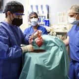 Investigadores hallan virus en corazón de cerdo trasplantado a hombre