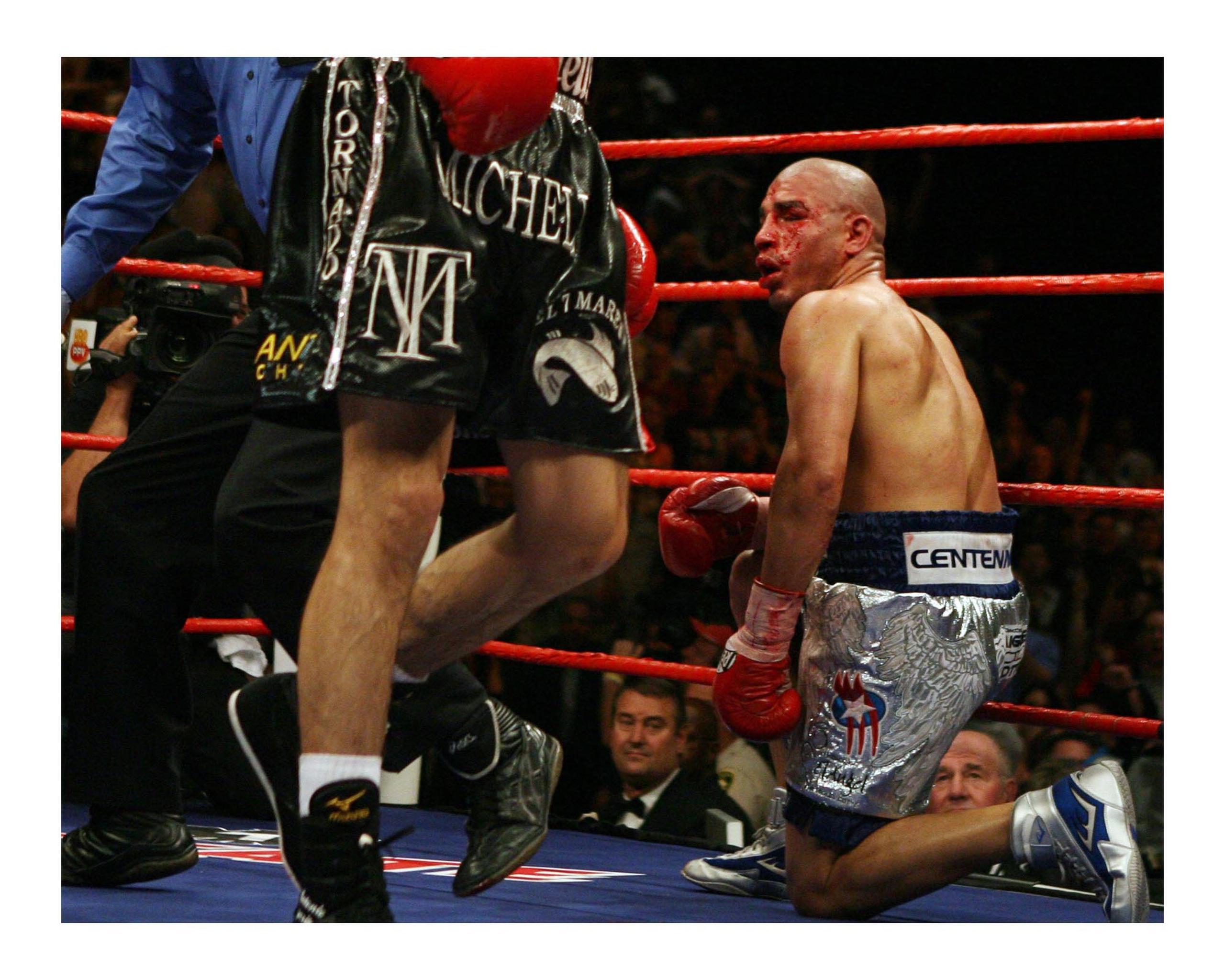 Miguel Cotto recibió uno de los más duros castigos de su carrera ante Antonio Margarito en su combate del 26 de julio de 2008. Aún así resistió combate hasta el undécimo asalto.

