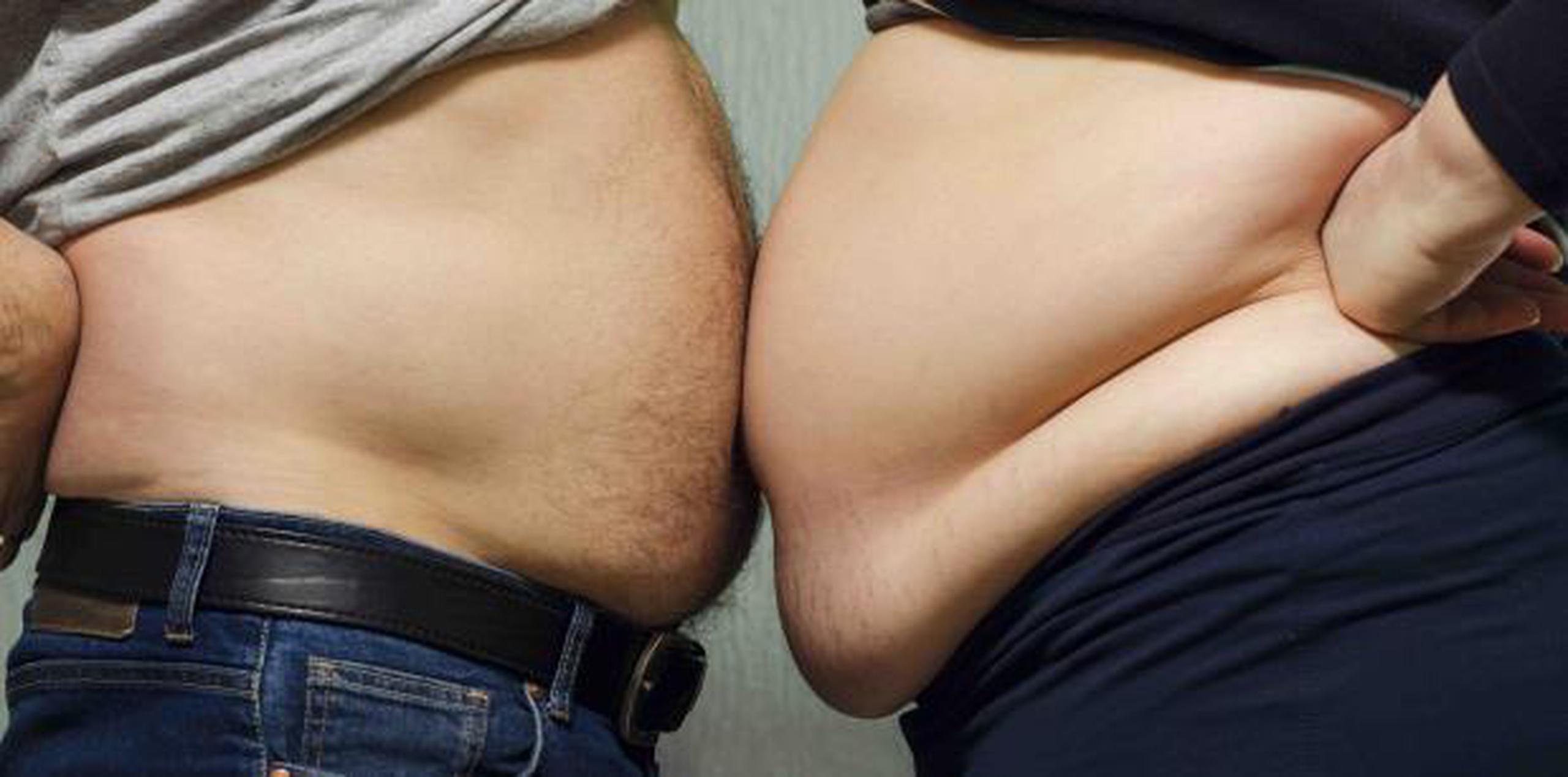 En el Reino Unido, las personas con exceso de peso superan el número de fumadores, de acuerdo a una investigación del Cancer Research UK. (Archivo)