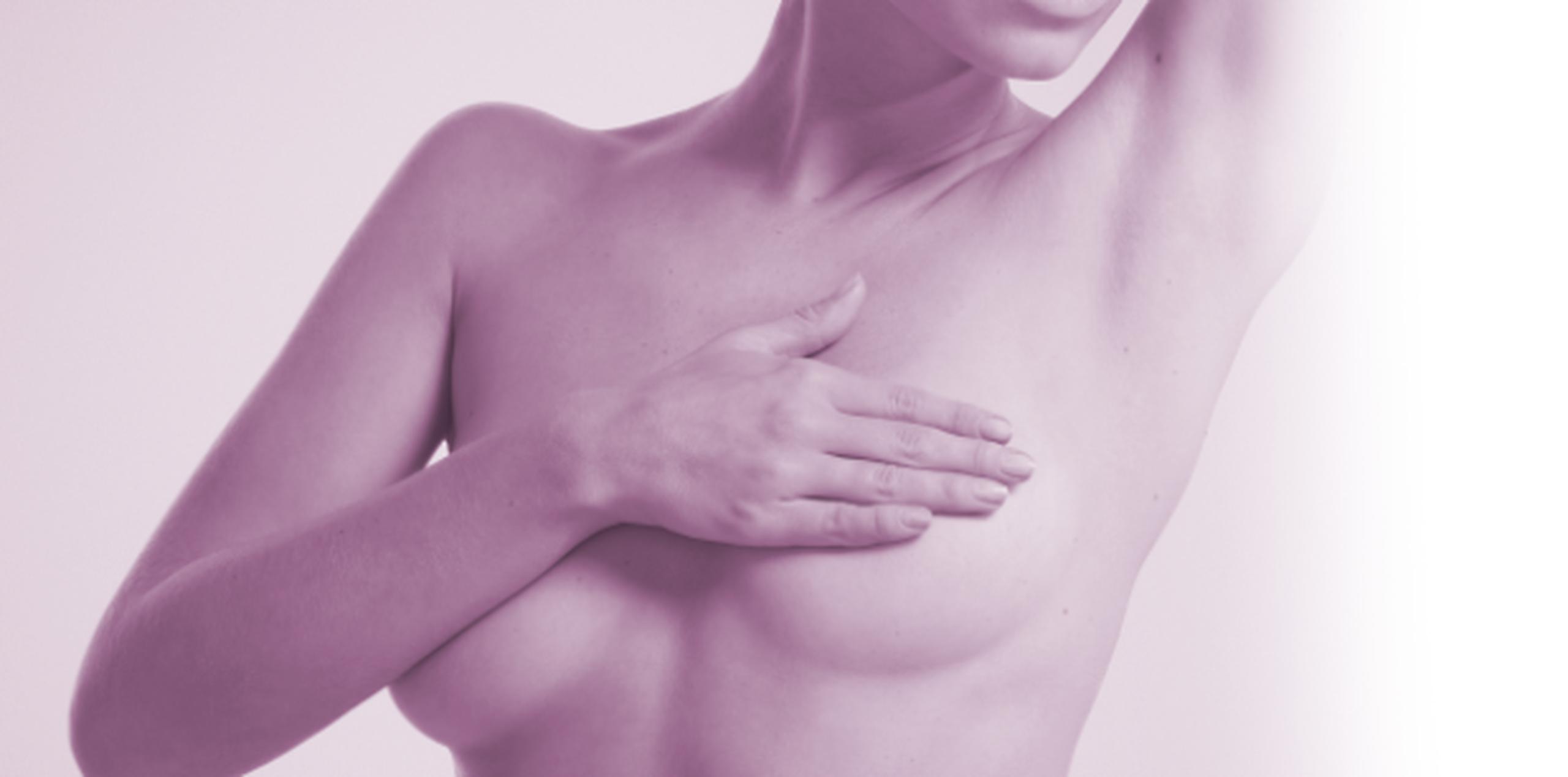 Según el Registro Central de Cáncer de Puerto Rico, el cáncer de mama es el más común entre los diagnosticados a las mujeres. (SHUTTERSTOCK)