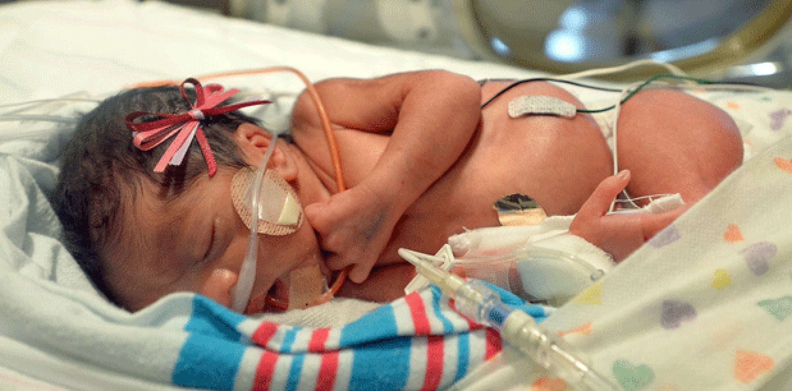 En Estados Unidos se registran 120 partos de trillizos por cada 100,000, nacimientos, aproximadamente. (Silvia Flores/The Fresno Bee via AP)