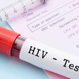 ¿Por qué ya existen vacunas contra el COVID-19 y aún esperamos una contra el VIH?