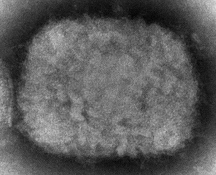 La viruela del mono es causada por el virus ortopoxvirus, similar al virus Variola.