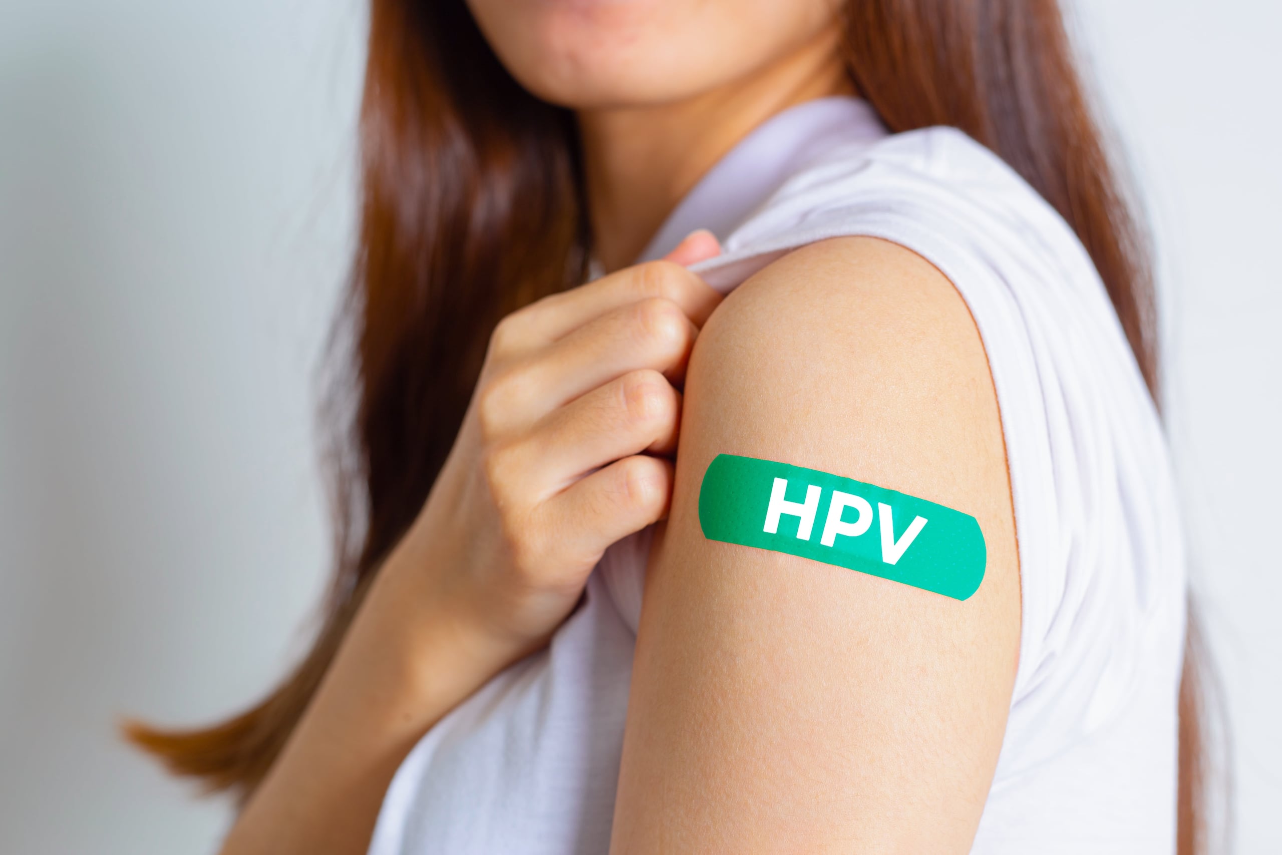 La vacuna contra el VPH puede prevenir la infección por los tipos de VPH más comunes que causan verrugas genitales y cáncer de cuello uterino.