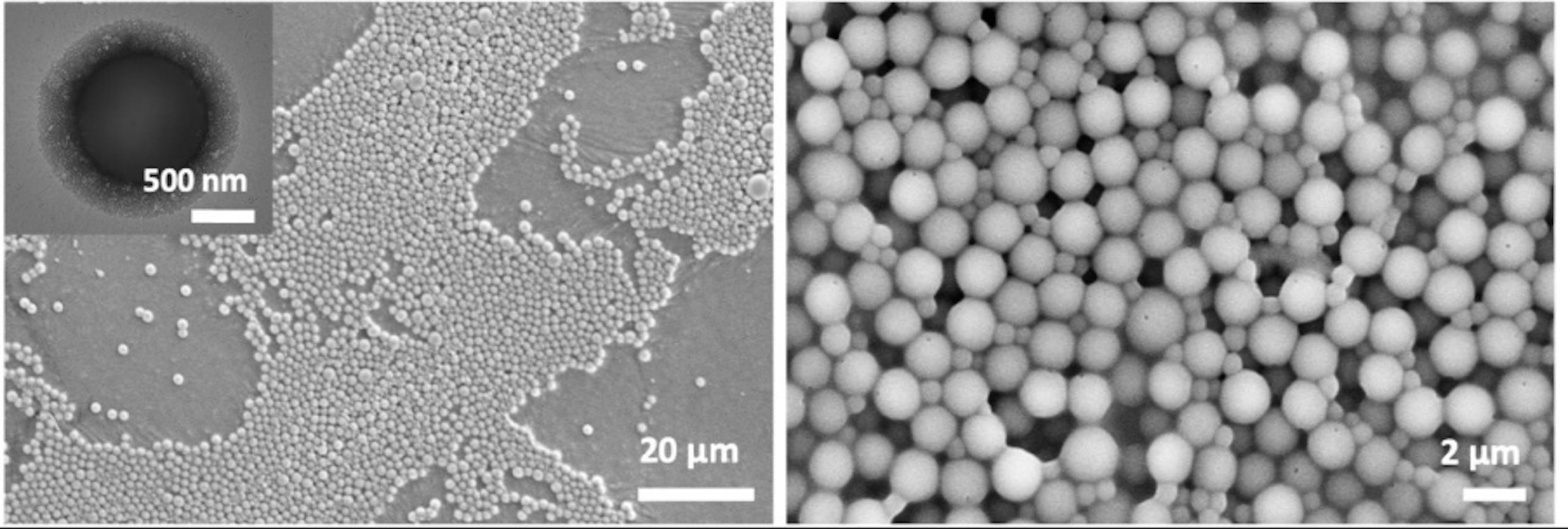 Imágenes tomadas con microscopio electrónico de barrido (SEM en inglés) que muestran los sistemas creados en el grupo de Pérez-Mercader. En la figura de la izquierda, imagen tomada con un microscopio electrónico de transmisión (TEM) de una de las vesículas activas (células sintéticas) mostrando su interior transparente ocupado por moléculas activas, que hacen que el sistema evolucione química y físicamente. Foto facilitada por el propio investigador.