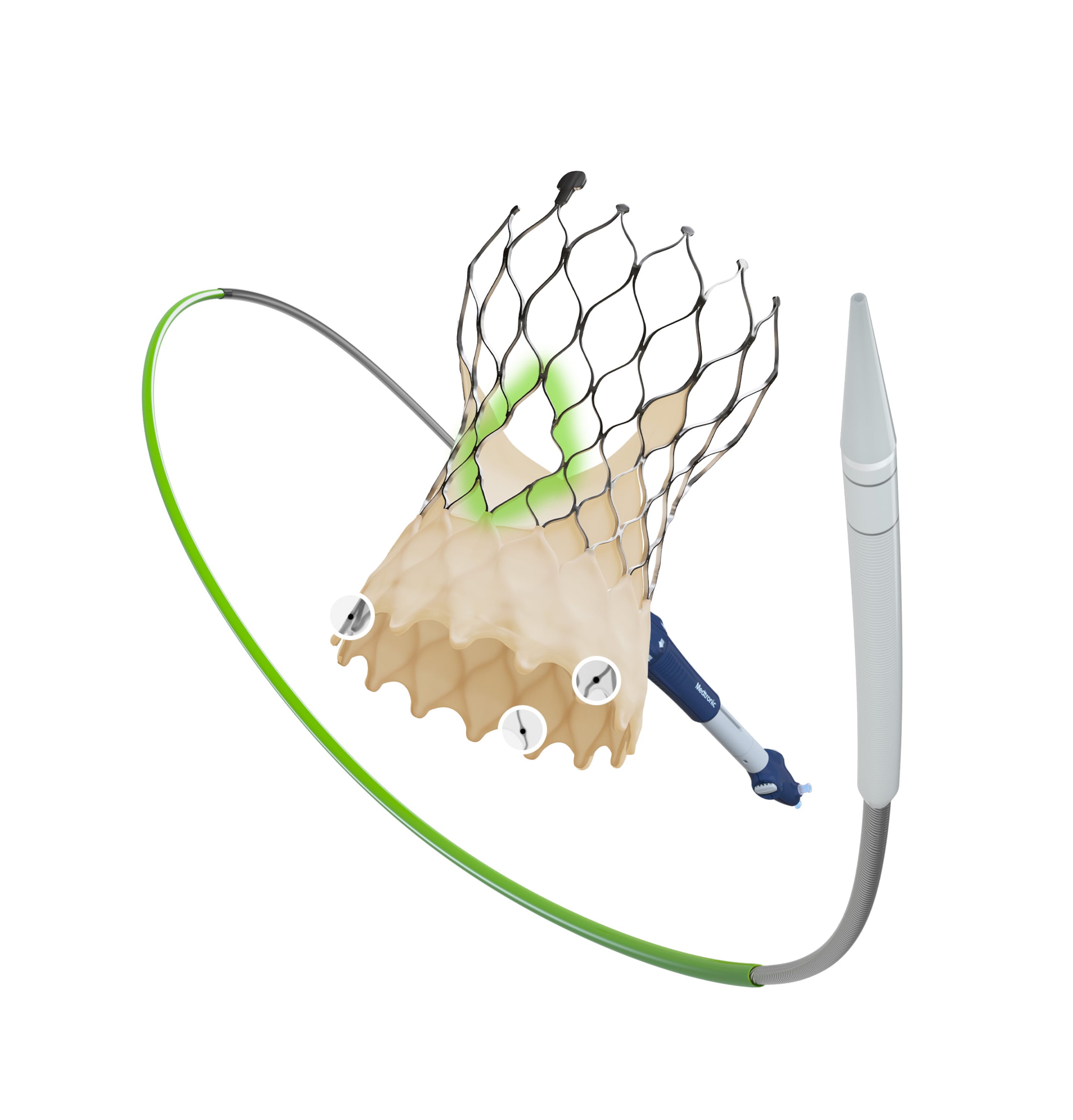 Con el sistema Evolut FX+, el acceso al corazón es más fácil en comparación con una cirugía de corazón abierto