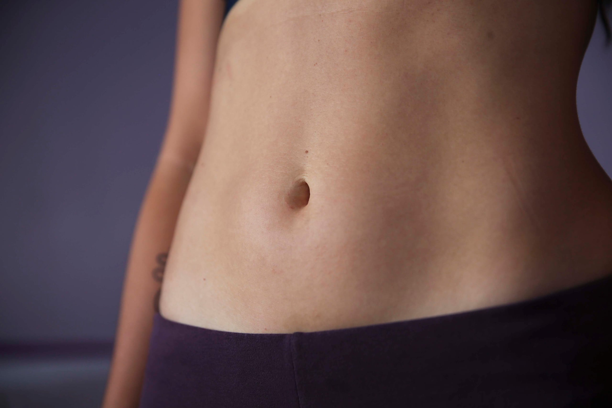 Durante años por su apariencia se convirtió en objeto de burlas y se avergonzaba de utilizar un bikini o quitarse la blusa durante la clase de gimnasia para evitar que nadie vira su cicatriz.