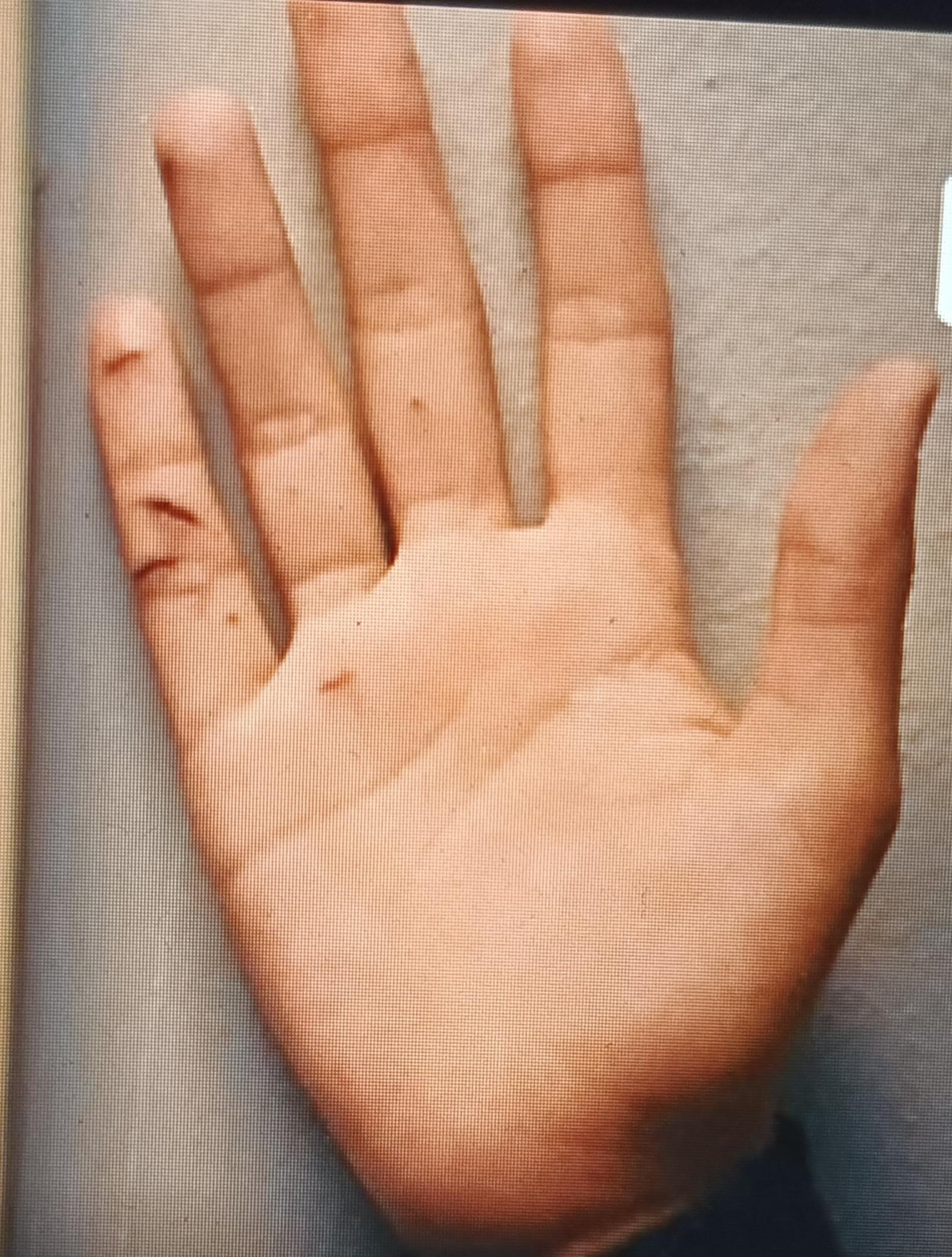 El Ministerio Público mostró una imagen de la mano de Anthonieska Avilés con cortaduras durante el juicio por jurado contra Elvia Avilés Cabrera.