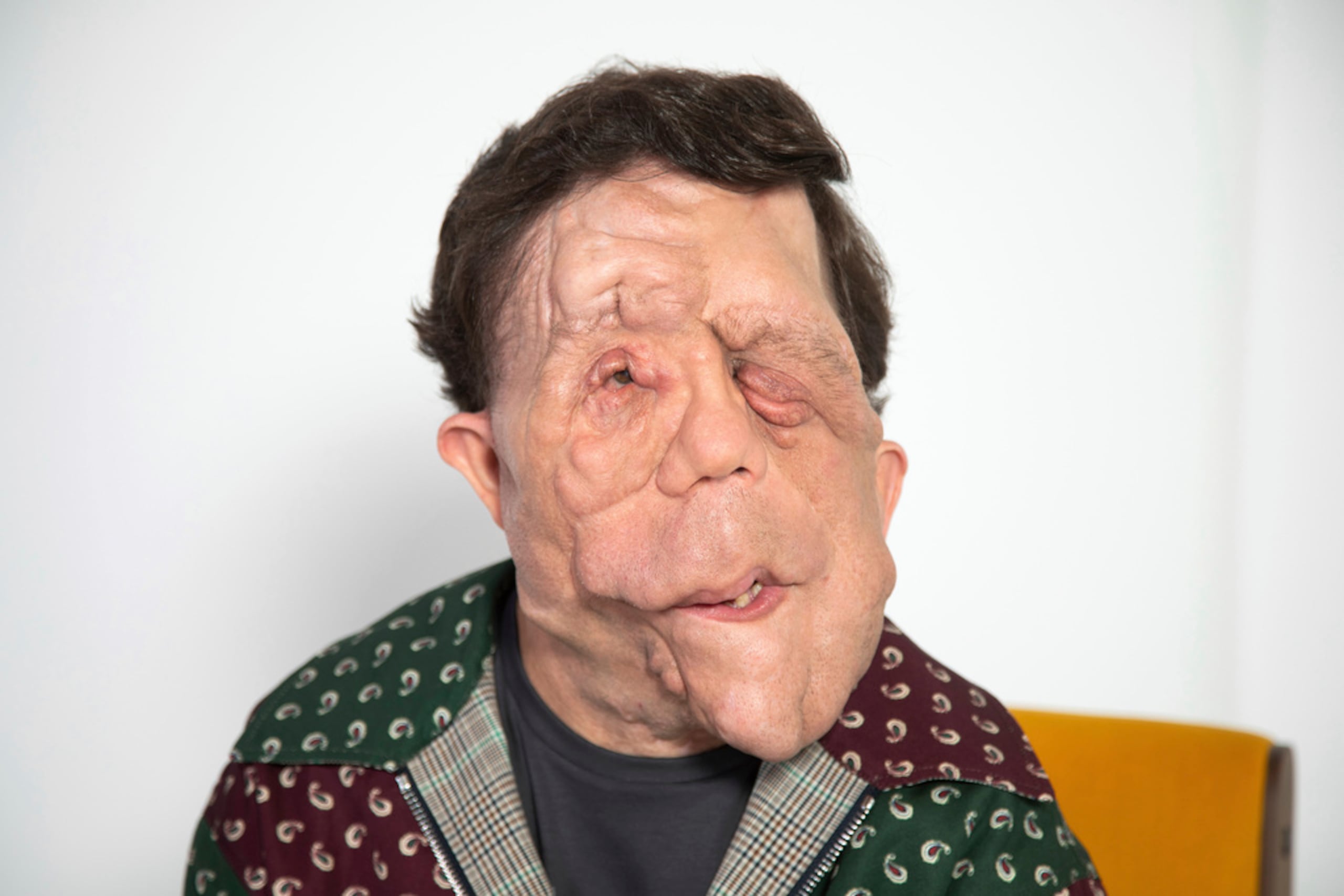 Adam Pearson posa para un retrato el 17 de septiembre de 2024, en Nueva York.