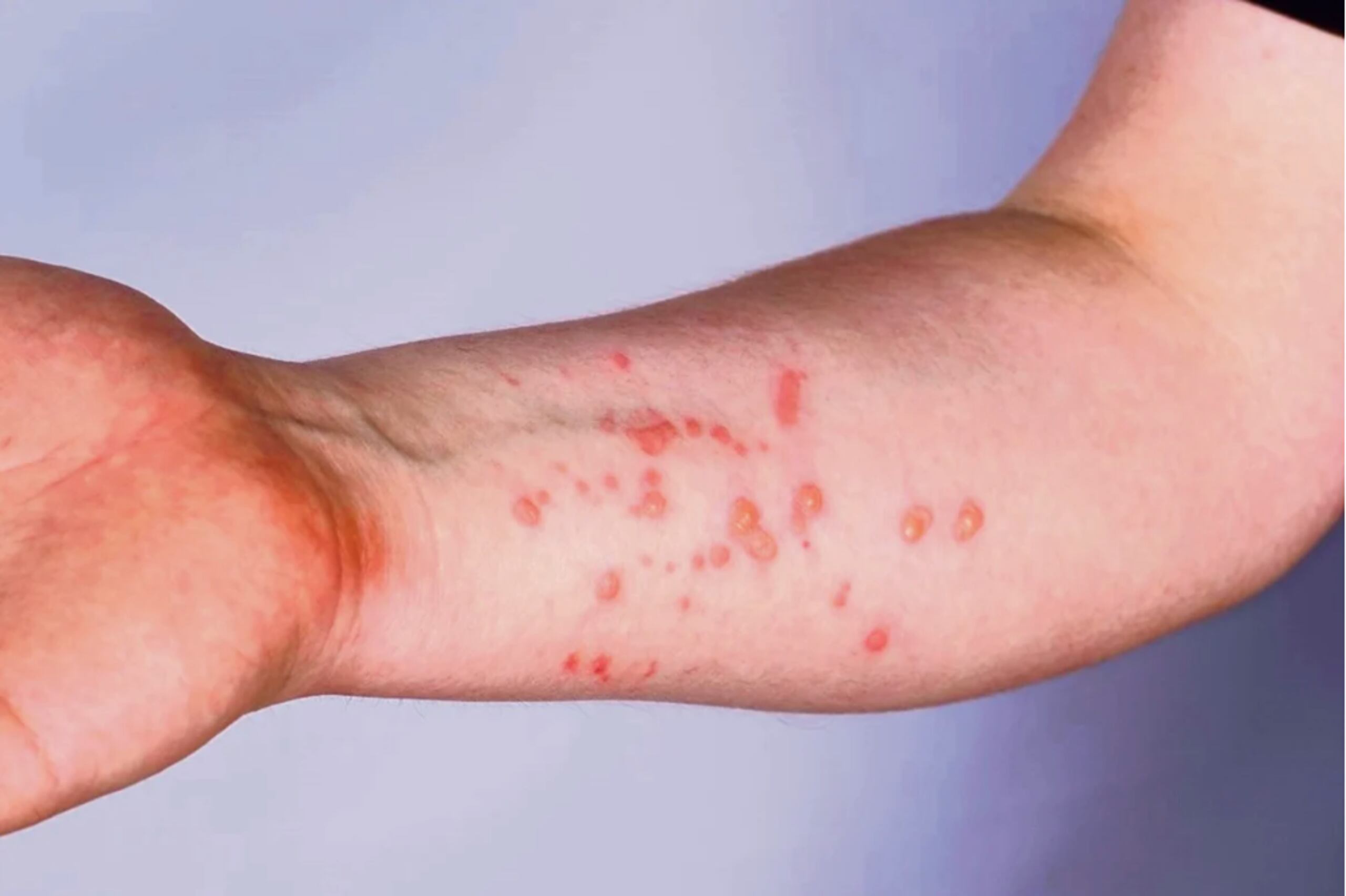 Indican que el virus evolucionó para volverse aún más infeccioso y mejor para evadir pruebas.
