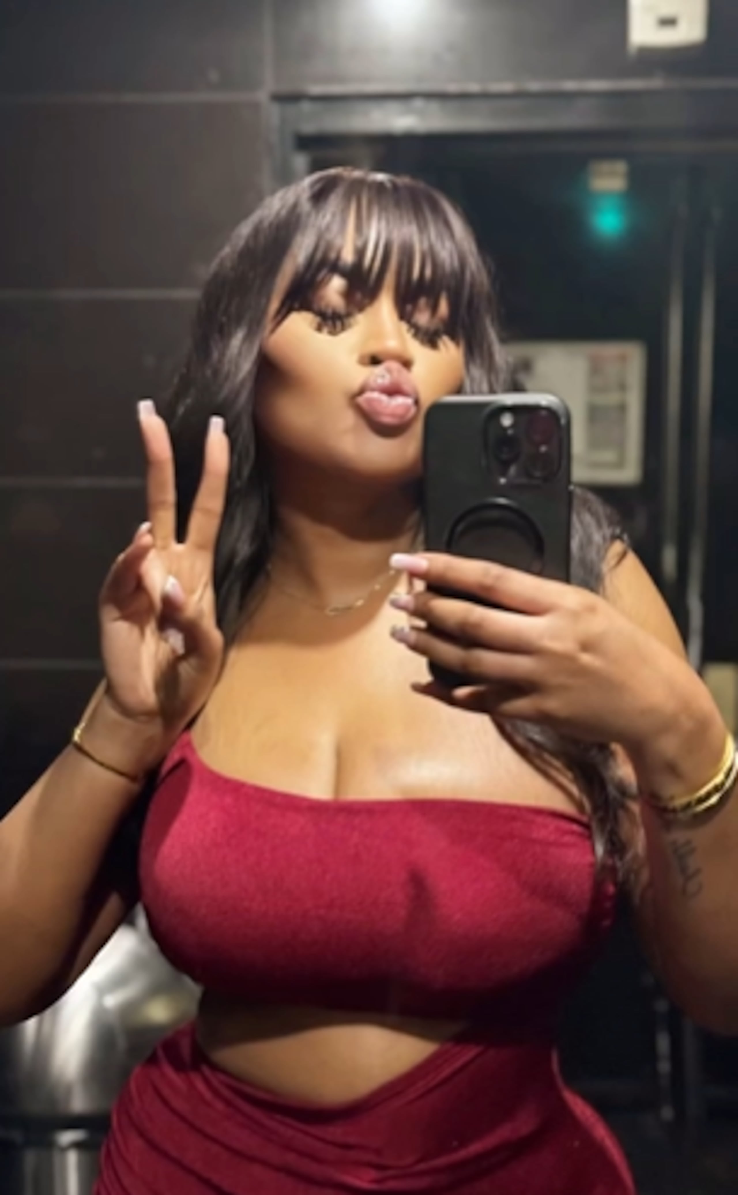 La madre de la modelo confirmó que la joven estaba por someterse a una cirugía en Turquía.