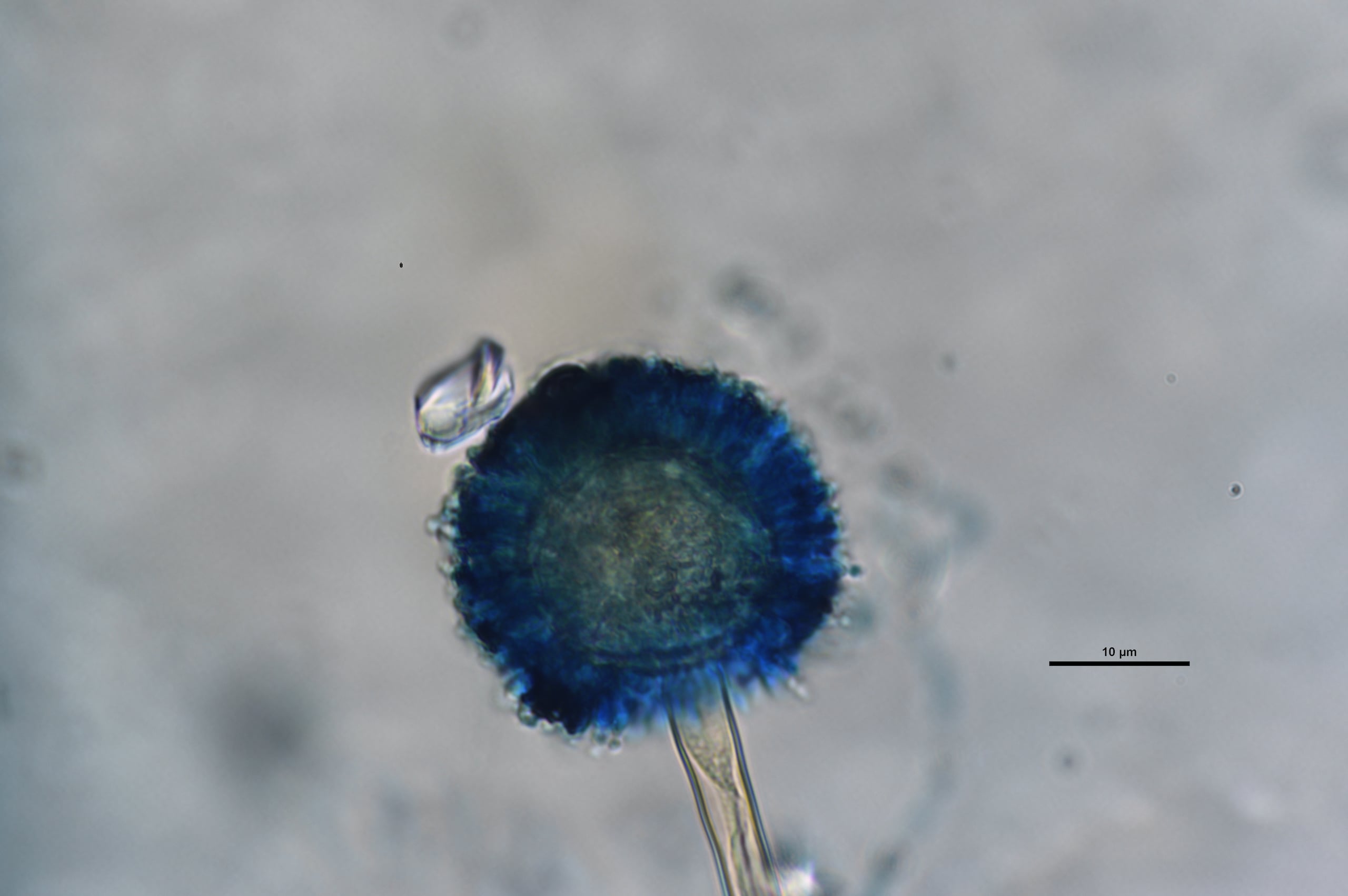 Colonias del hongo Aspergillus.