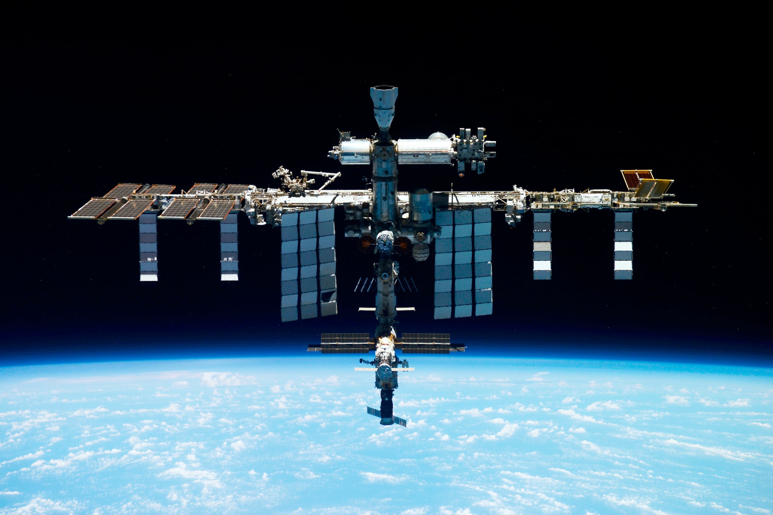 El proyecto busca revelar conocimientos cruciales sobre los mecanismos que sustentan la funcionalidad de las células madre en el espacio, lo cual podría tener profundas implicaciones para la exploración espacial y la medicina en la Tierra.