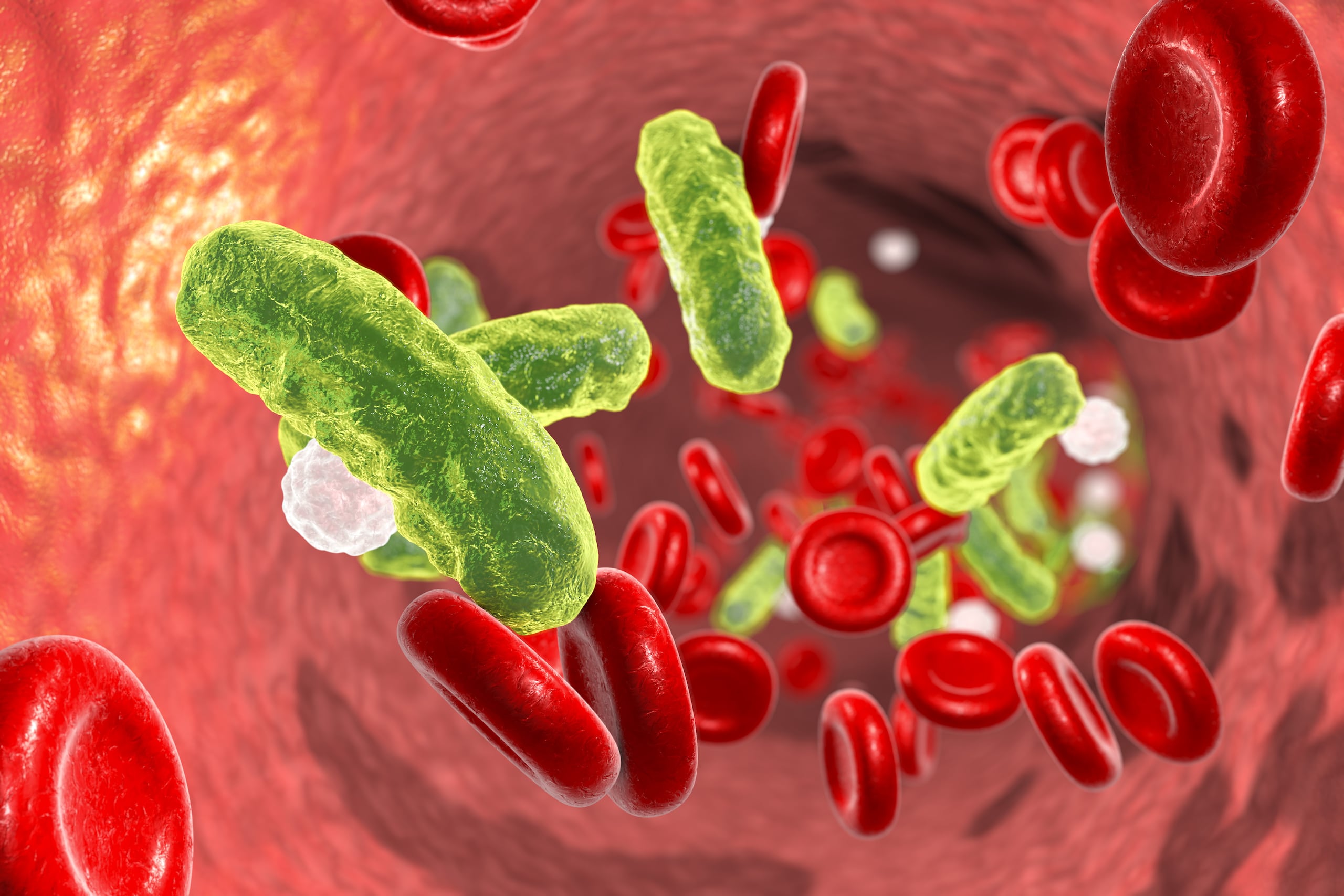 La sepsis se ubicó como un factor determinante de enfermedad y mortalidad en un contexto epidemiológico. (Shutterstock)