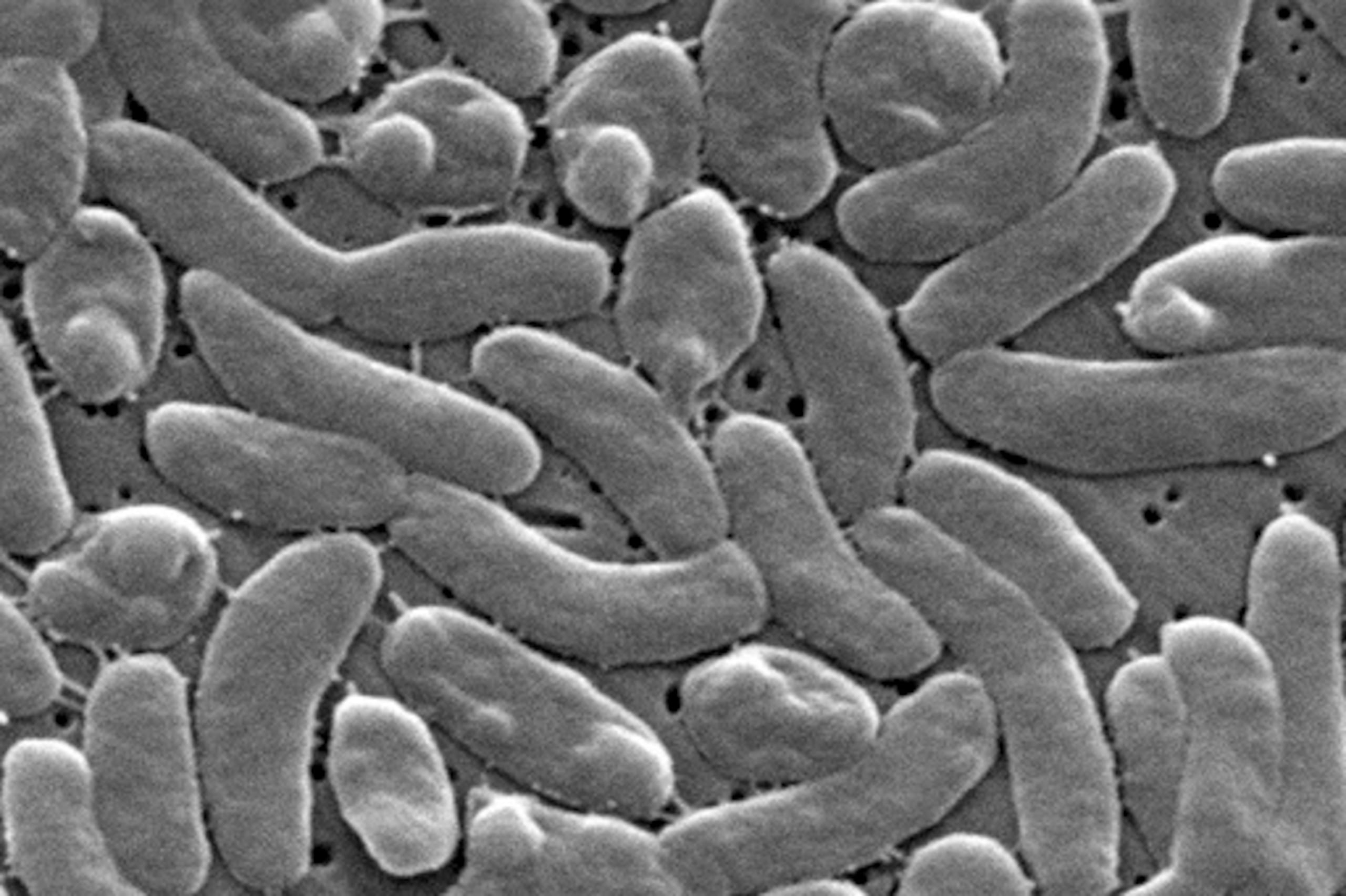 A la bacteria se le conoce como ‘come carne’ porque la infección en la sangre produce lesiones en la piel con ampollas, además de fiebre, escalofríos y presión baja.