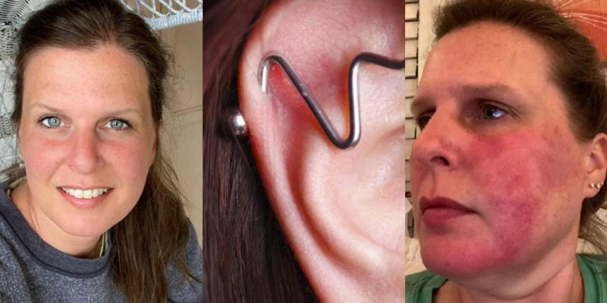 Después de haberse puesto la pequeña joya, empezó a ver cómo decaía su salud.