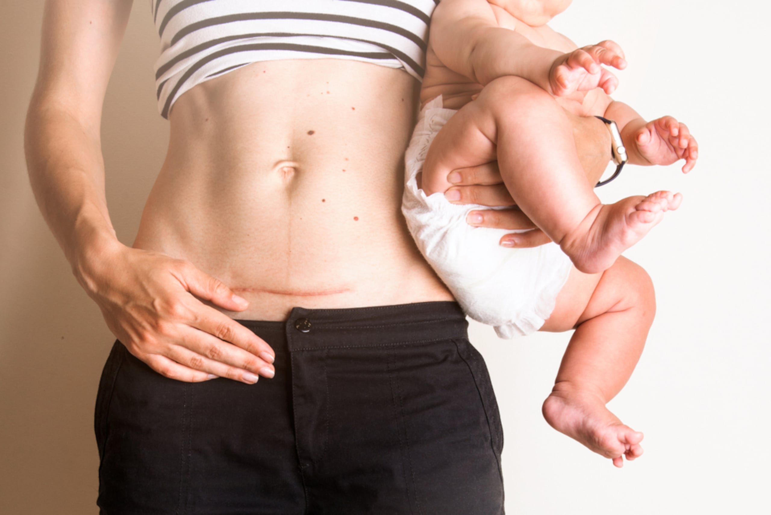 El mayor aumento se produjo en madres menores de 20 años, un tramo en el que pasó del 37% a más del 42%, según el reporte.