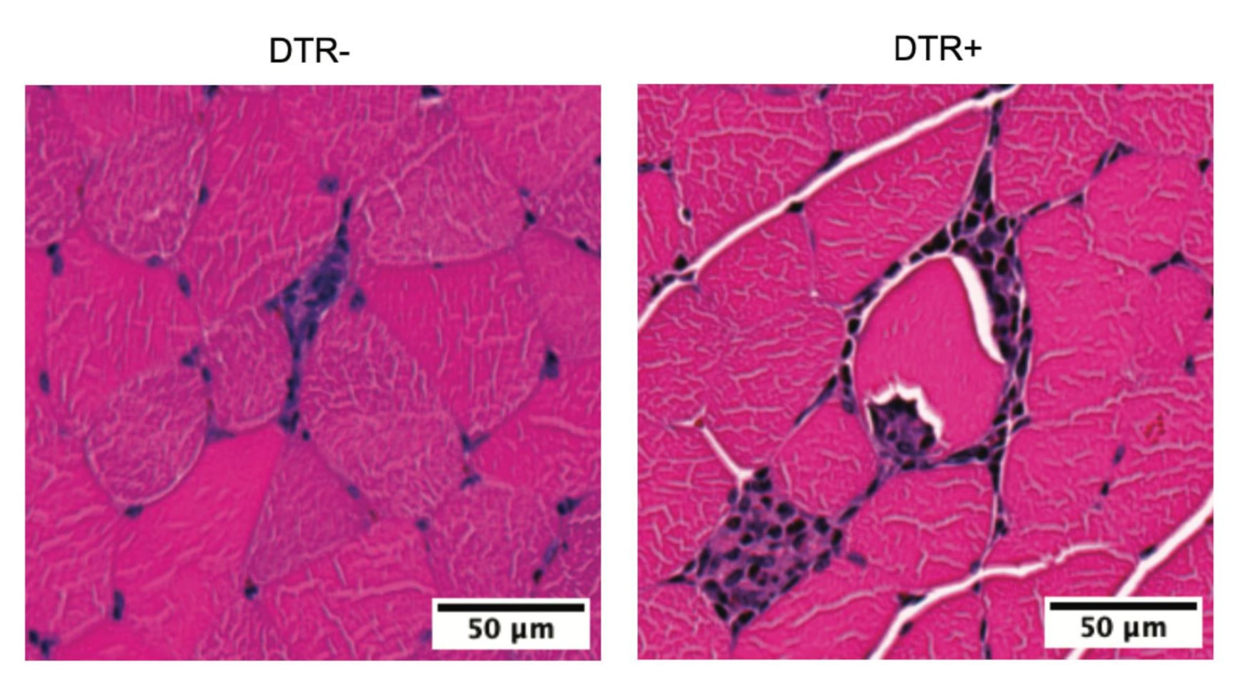Los músculos de las patas traseras de ratones sin células T (derecha) mostraban signos prominentes de inflamación tras el ejercicio regular, en comparación con los de ratones con T intactas (izquierda). La investigación demostró que esta inflamación incontrolada afectaba negativamente al metabolismo y la función musculares. (Crédito: Kent Langston/Laboratorio Mathis, HMS)