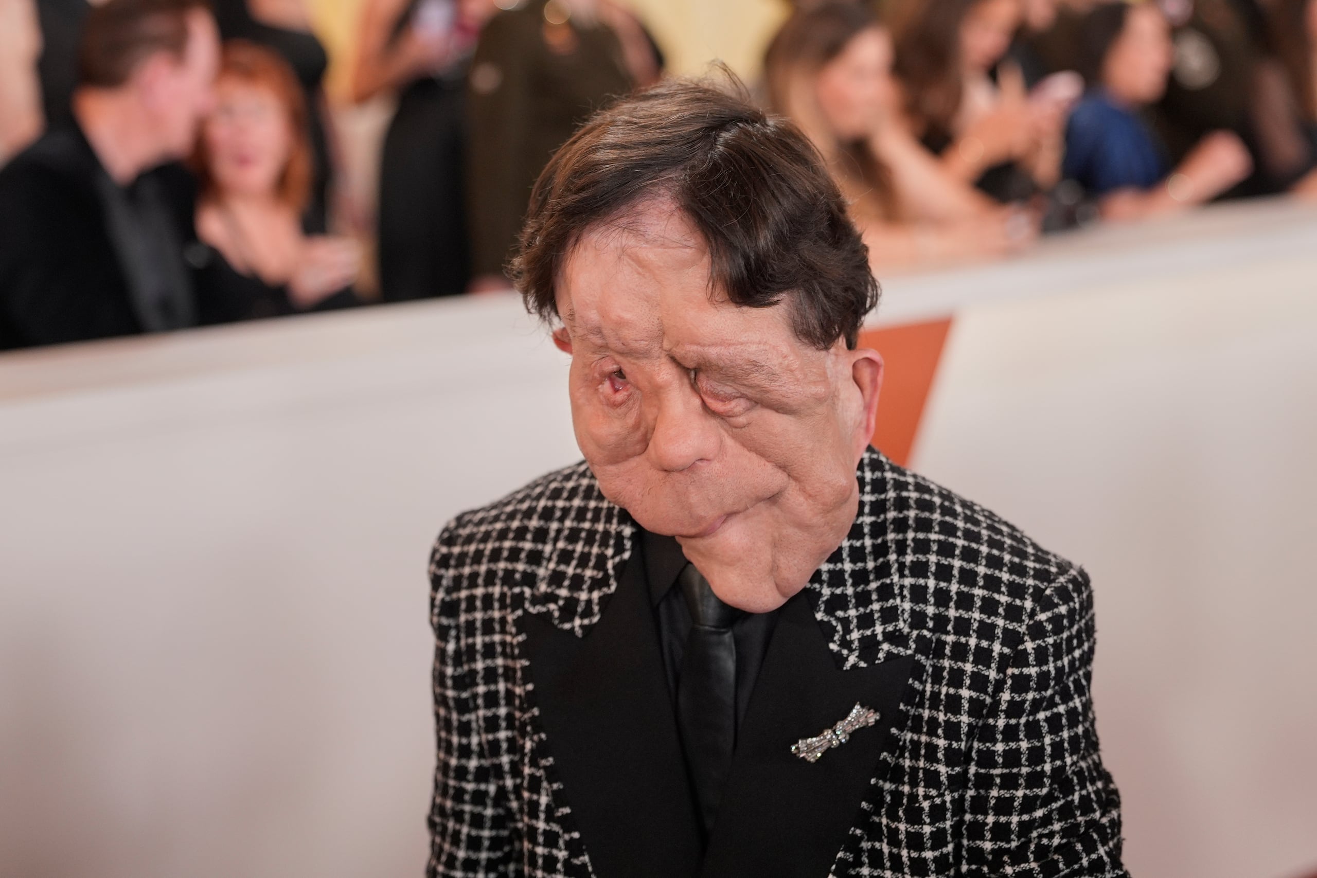 Adam Pearson llega a la ceremonia de los Oscar en el Dolby Theatre en Los Angeles.