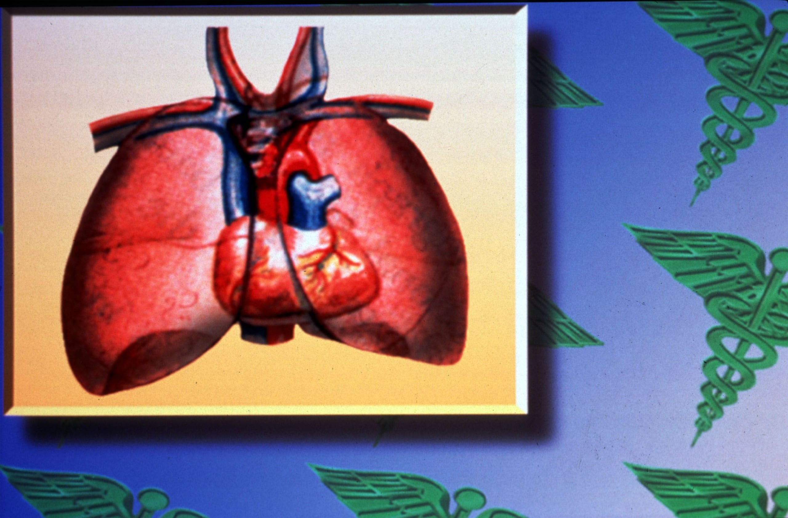 La enfermedad del legionario es una infección pulmonar grave. (Archivo / GFR Media)