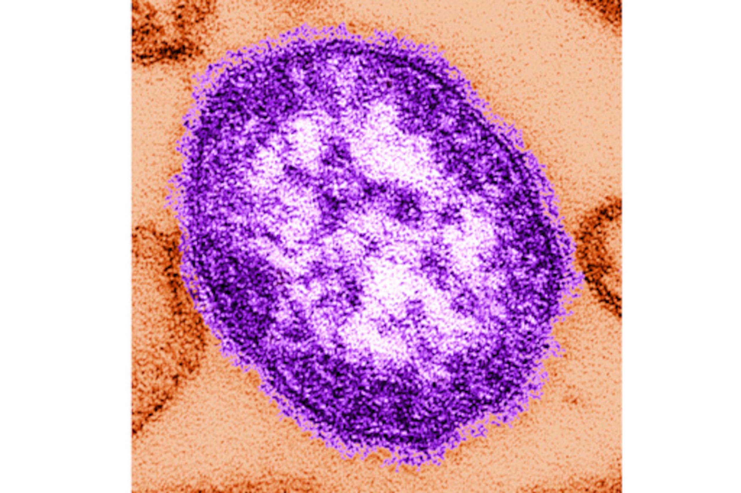 ARCHIVO - Esta imagen sin fecha, facilitada por los Centros para el Control y la Prevención de Enfermedades el 4 de febrero de 2015, muestra una imagen al microscopio electrónico de una partícula del virus del sarampión. (Cynthia Goldsmith/Centros para el Control y la Prevención de Enfermedades, vía AP, archivo)