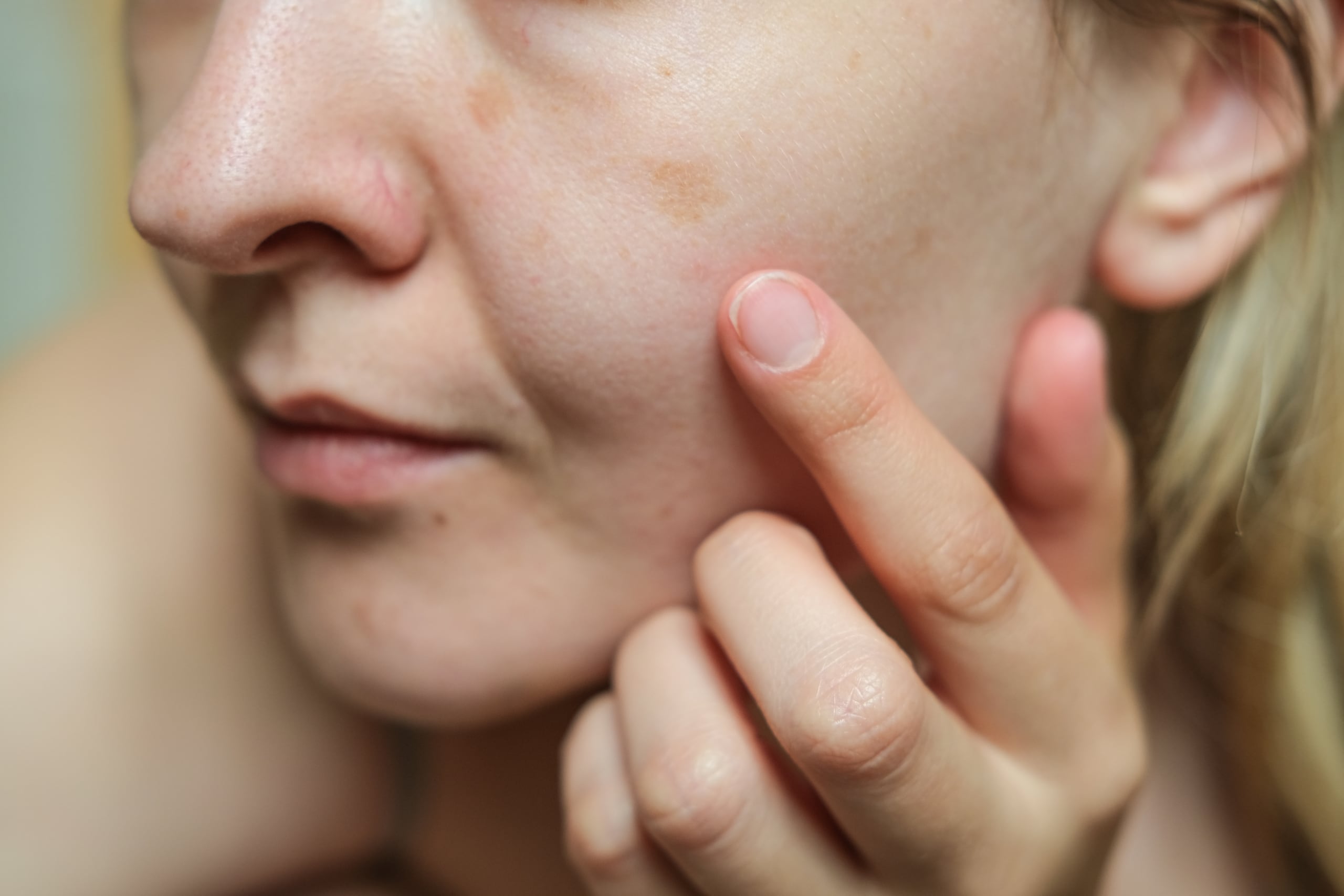 En dermatología existe un principio sencillo: es preferible evaluar diez manchas benignas que pasar por alto una lesión importante.