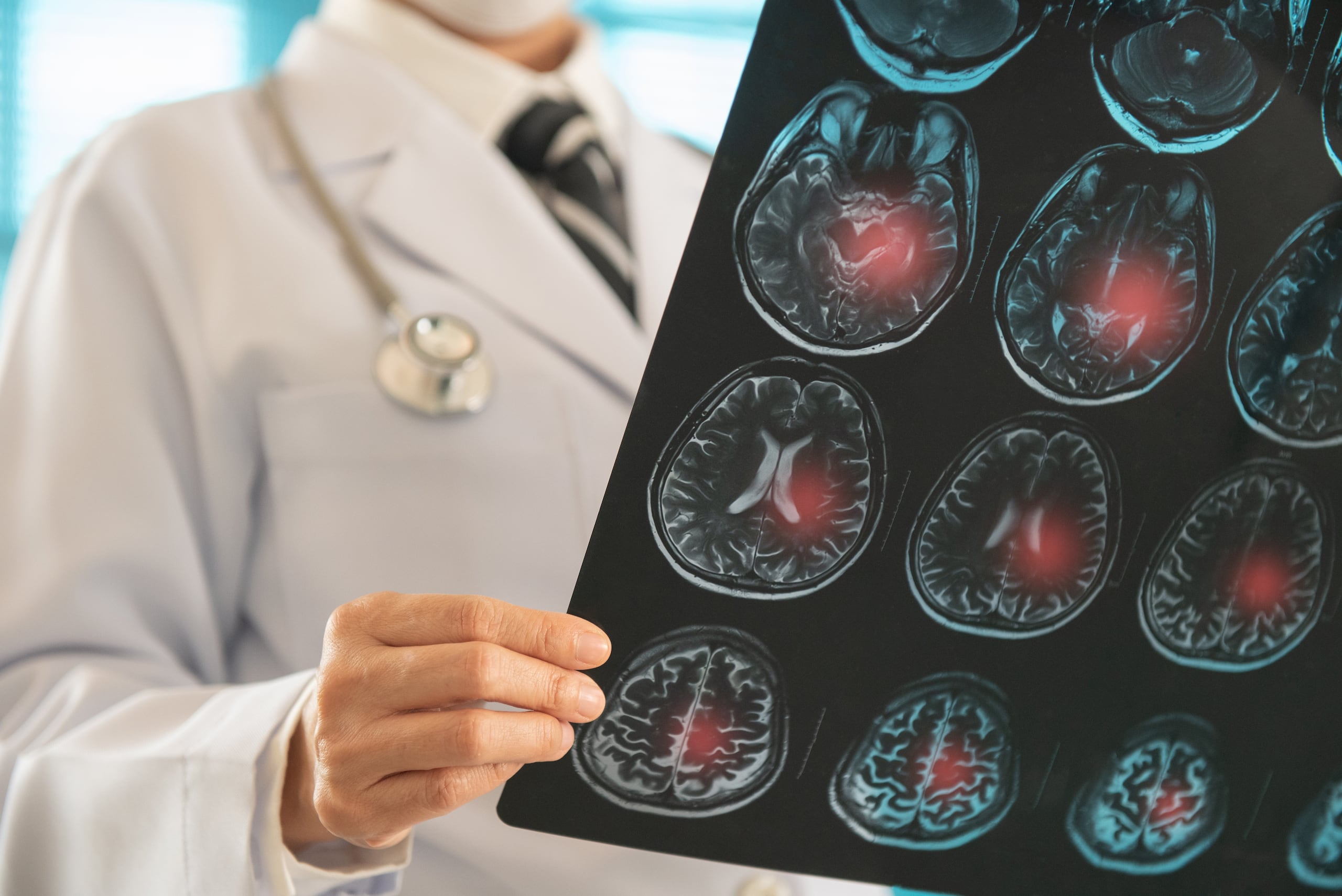 La tomografía computarizada permite detectar tumores, infecciones, coágulos, hemorragias internas o enfermedades pulmonares y cardiacas.