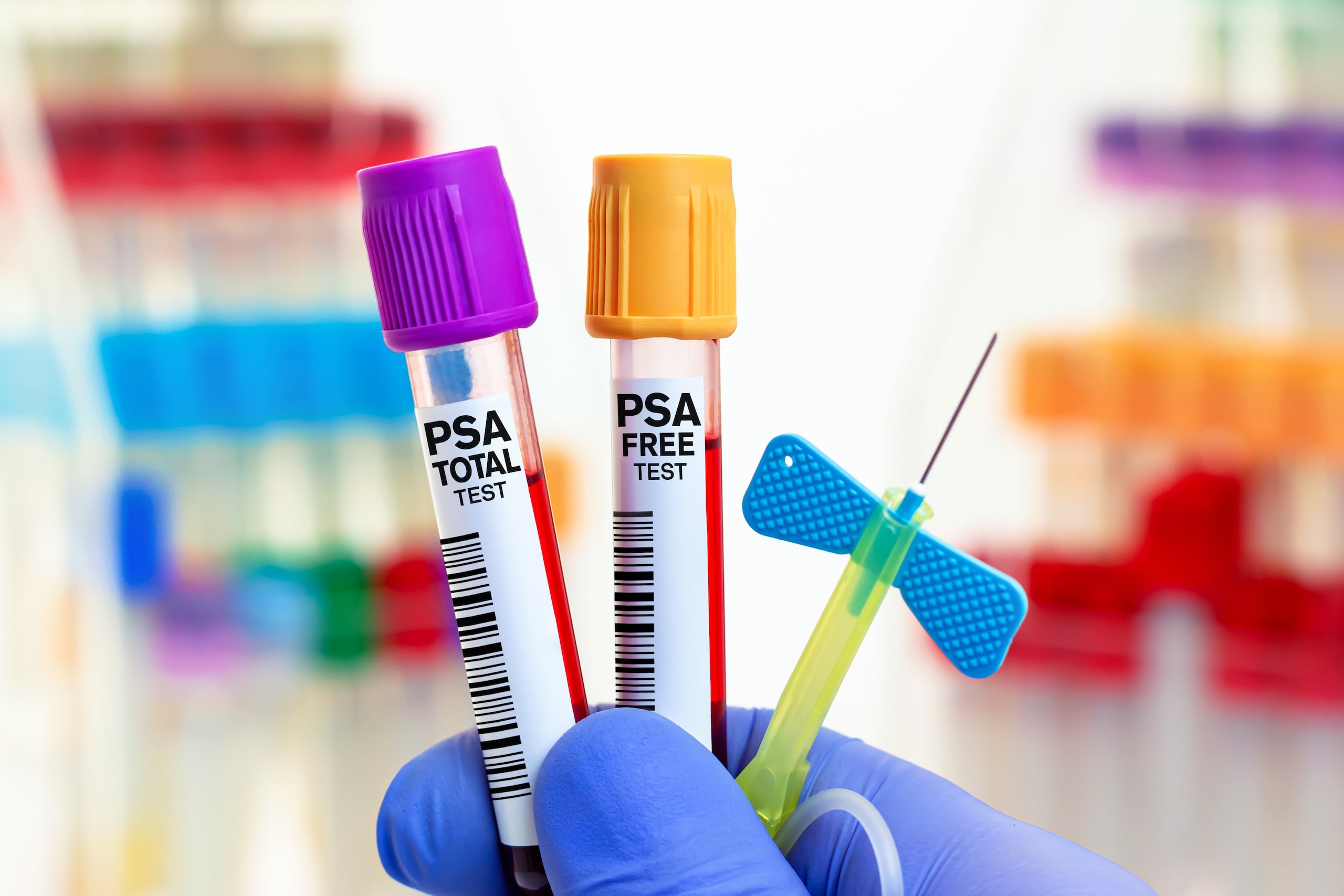 Los hombres a partir de los 50 años —o desde los 45 si tienen factores de riesgo, como historial familiar de cáncer de próstata— deben hablar con su médico sobre la posibilidad de realizarse la prueba de PSA.