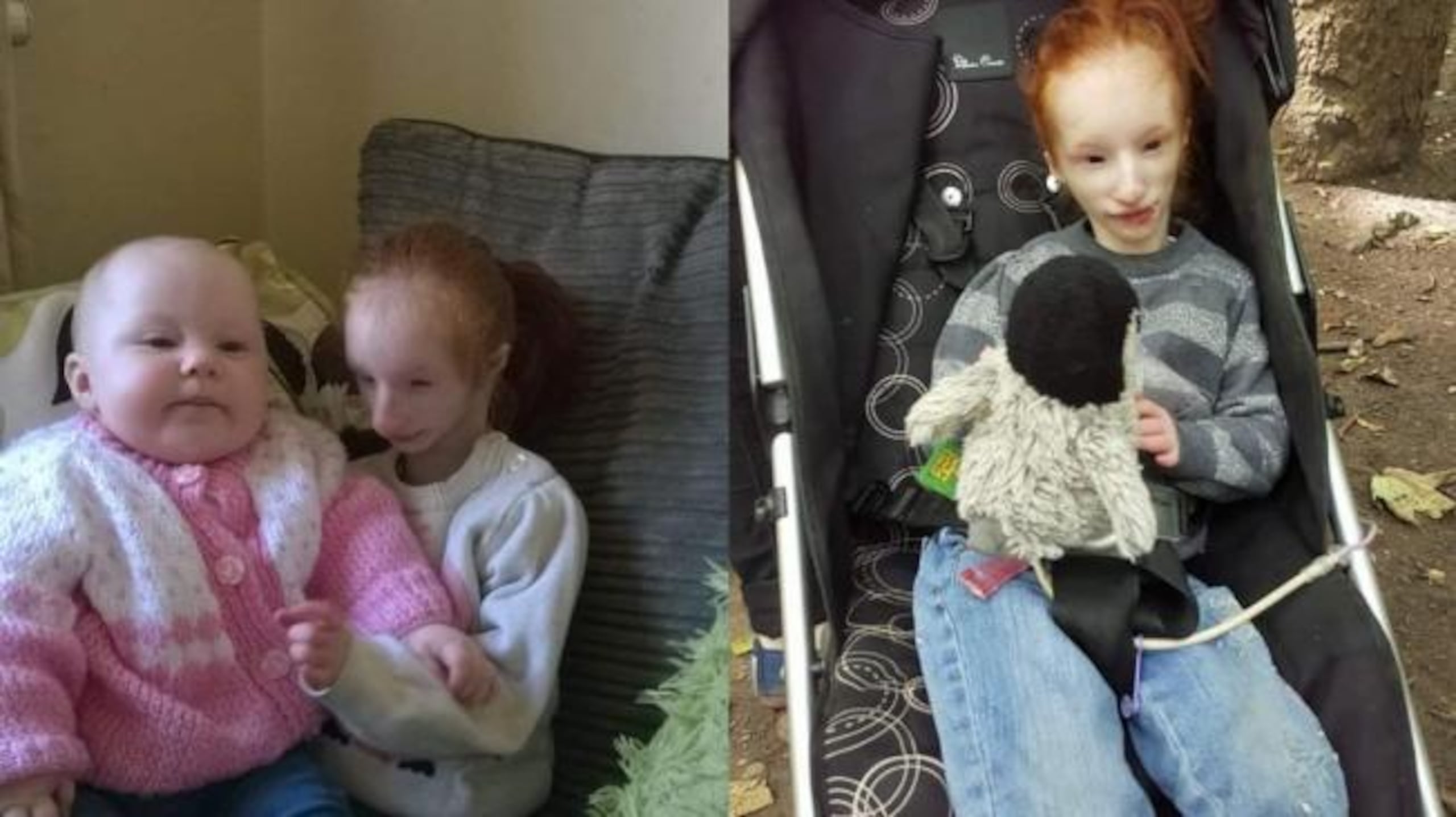 Charlotte Garside, la niña más pequeña del mundo.