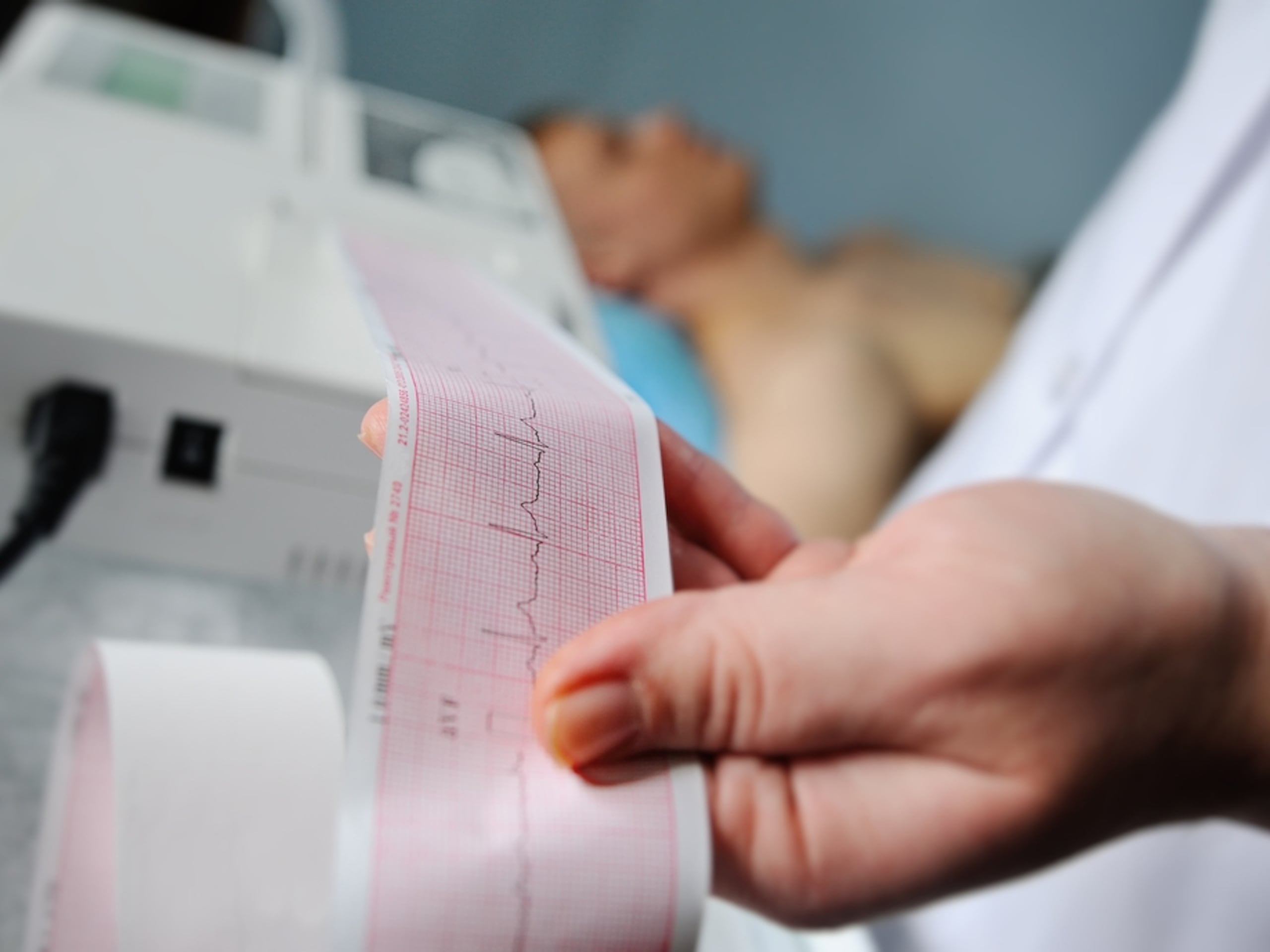 El electrocardiograma es la prueba más sencilla y básica. Hacerla toma unos segundos y está disponible en casi todas las oficinas de medicina cardiovascular.