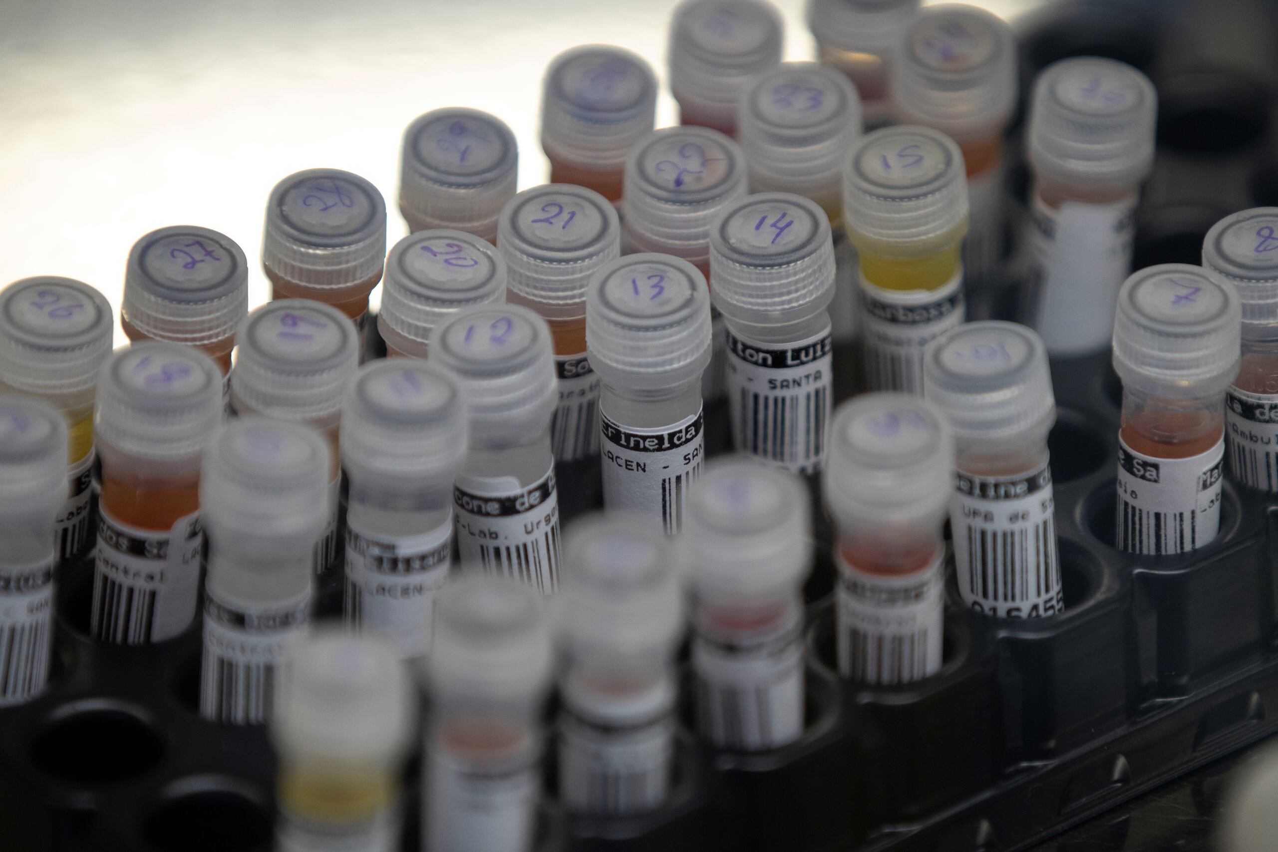 Hoy la Asociación de Laboratorios Clínicos anunció que redobló esfuerzos para lograr la eliminación de la enmienda (Art.2.02 (l)), del P. del S. 258, que permitiría a las farmacias realizar pruebas de laboratorio.