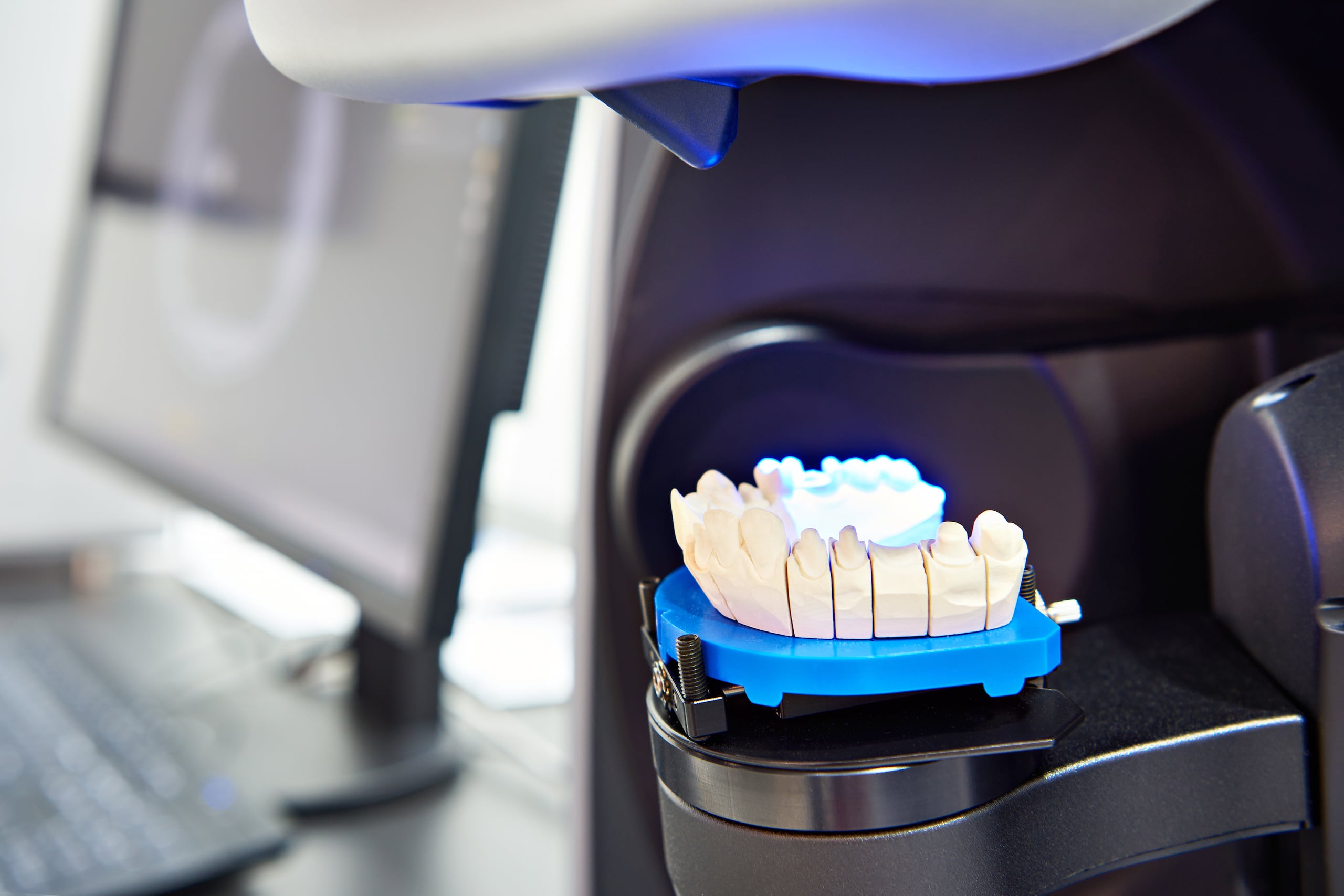 Escáner extraoral o CT Scan dental