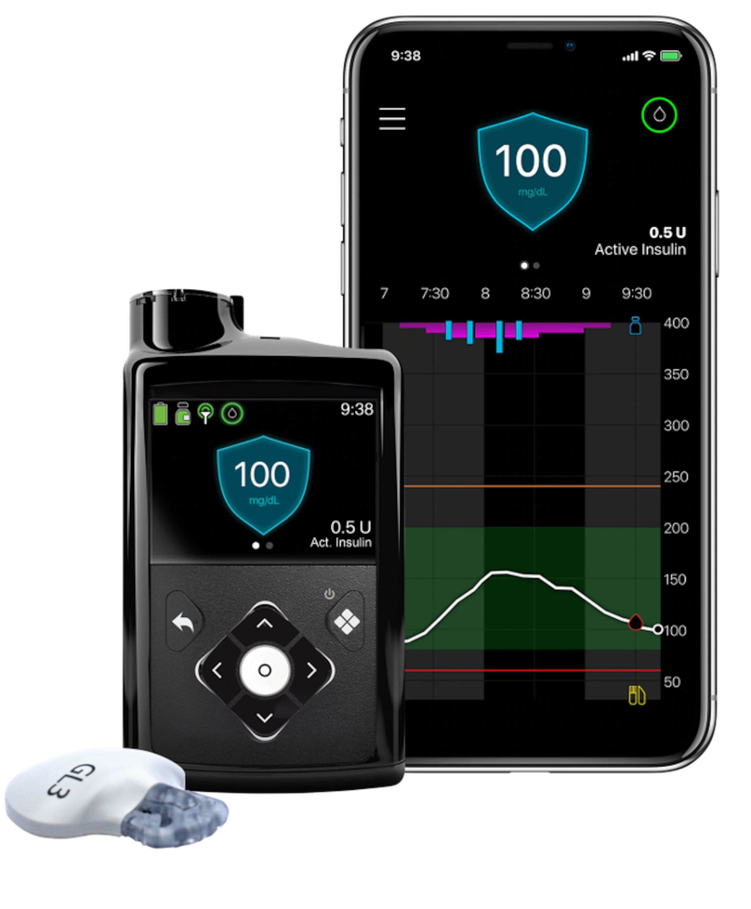 El sistema MiniMed 780G se conecta a un sensor que monitorea, cada cinco minutos, el azúcar del paciente, informando a la bomba los niveles de glucosa en la sangre.