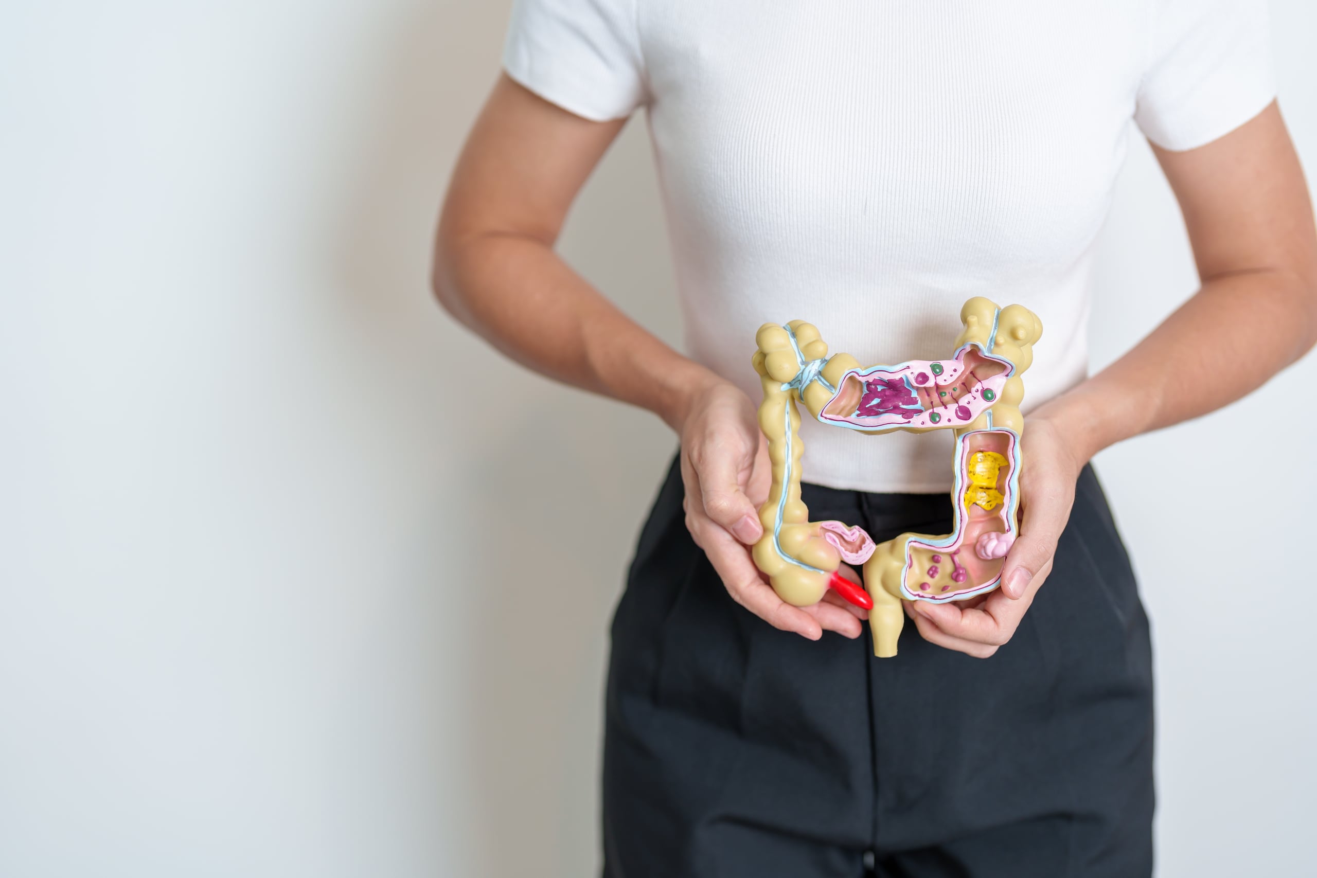 Un estilo de vida saludable es determinante en la intención de la prevención.