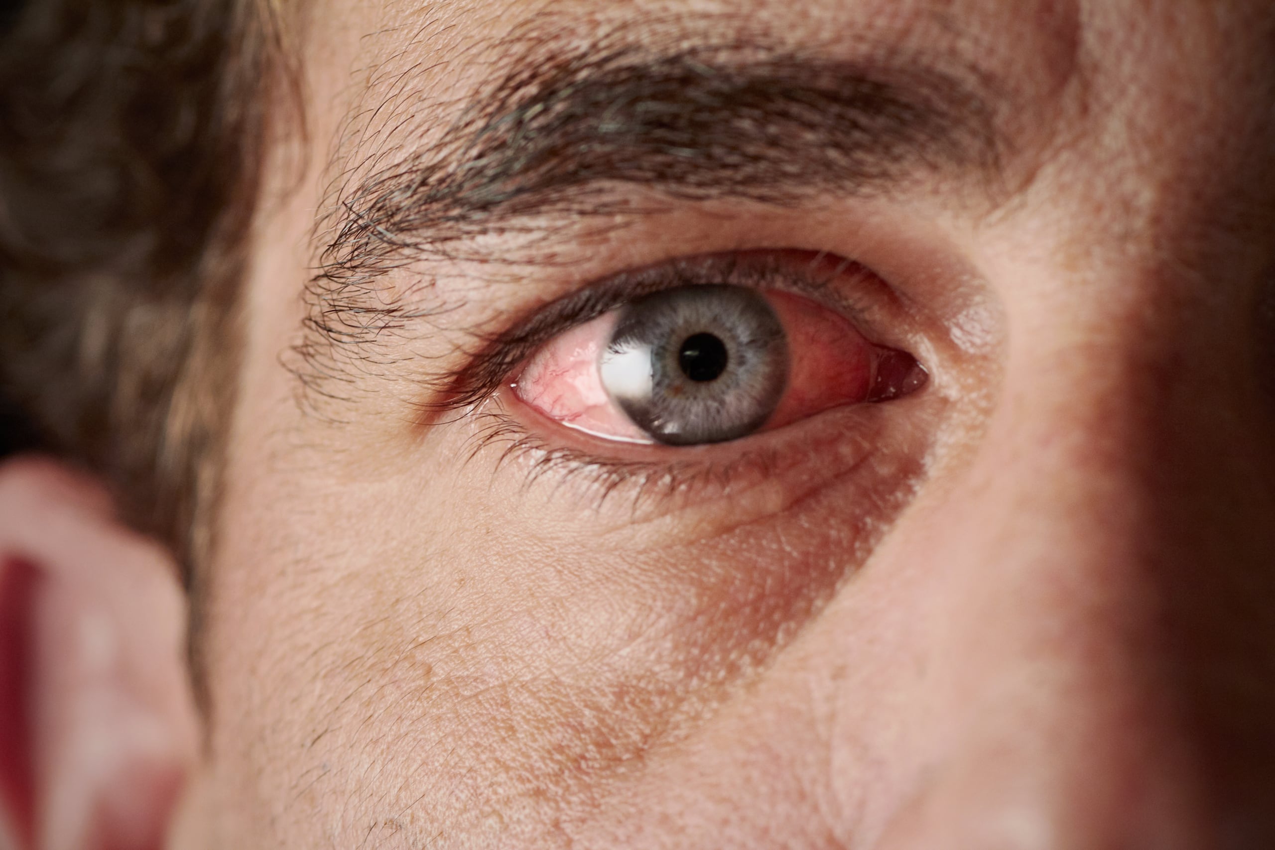 El nuevo método podría ayudar a restaurar o preservar la función visual en personas con síndrome de Usher tipo 1B, así como en pacientes con otras enfermedades oculares hereditarias causadas por defectos en genes que, hasta ahora, no se podían transferir mediante procedimientos estándar de terapia génica, informaron los científicos.