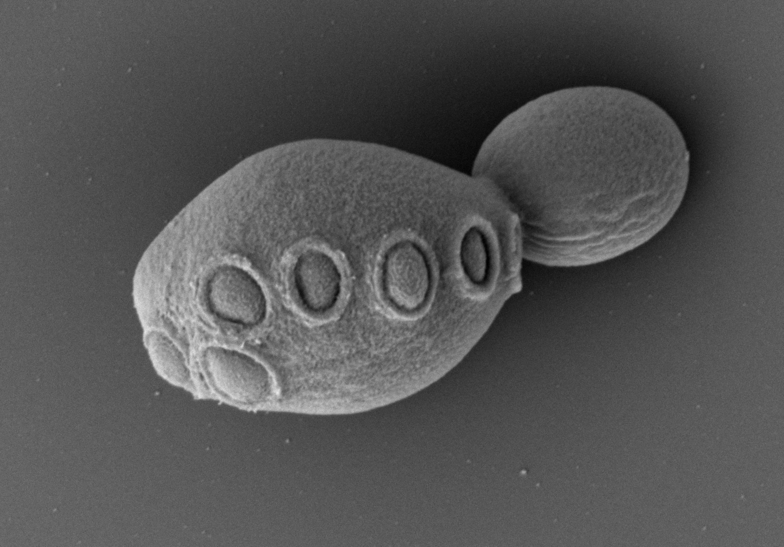 Los investigadores construyeron un cromosoma sintético que sustituyó a uno de los 16 que tiene la levadura y, tras un laborioso proceso de depuración, ahora permite a la célula crecer con el mismo nivel de aptitud que una célula natural.