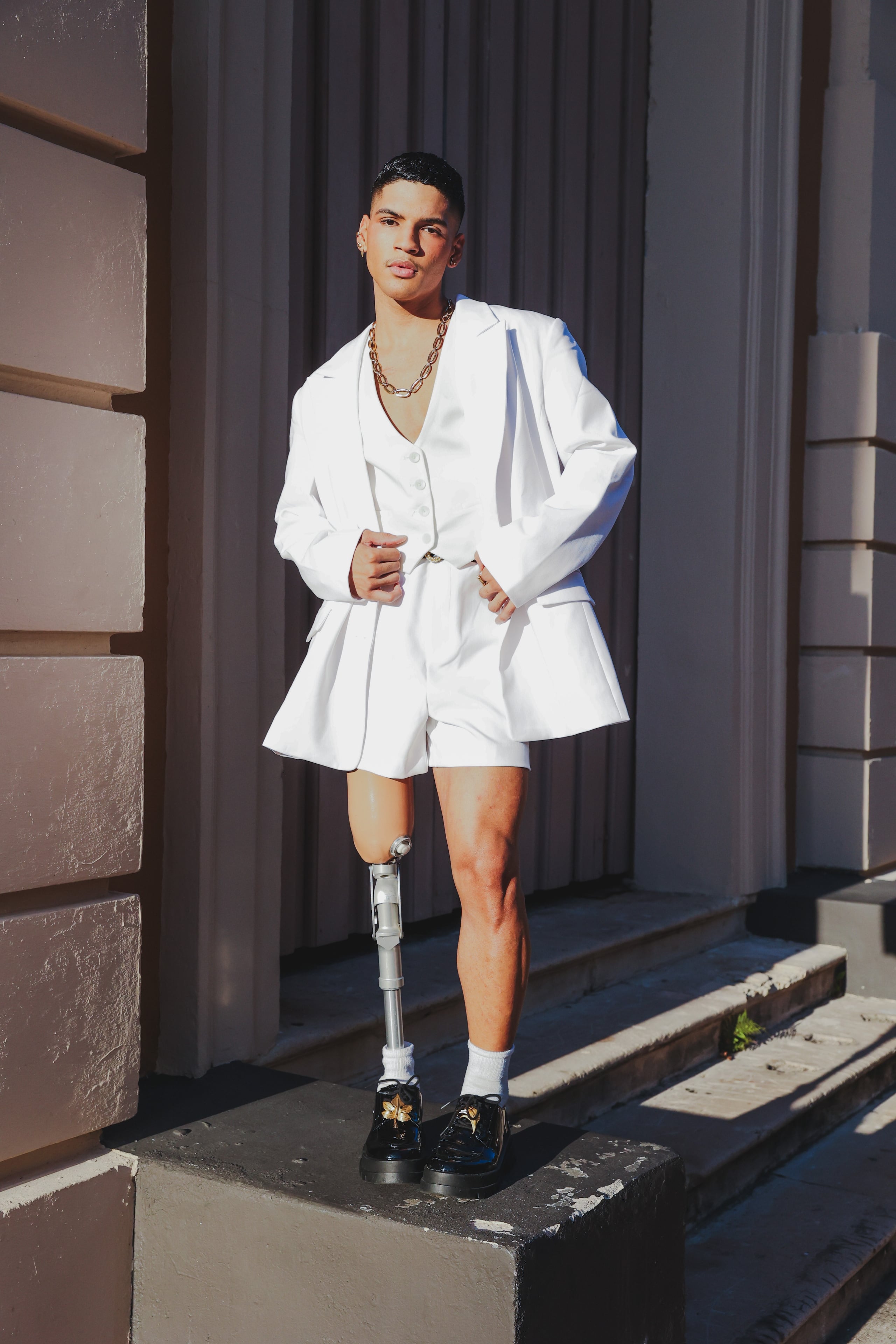 Sobrevivir, no solo al cáncer, sino a la amputación de su extremidad, a la pérdida de su madre y de su hermano, le ha forjado su carácter contra esta enfermedad. (@eloia.photo)