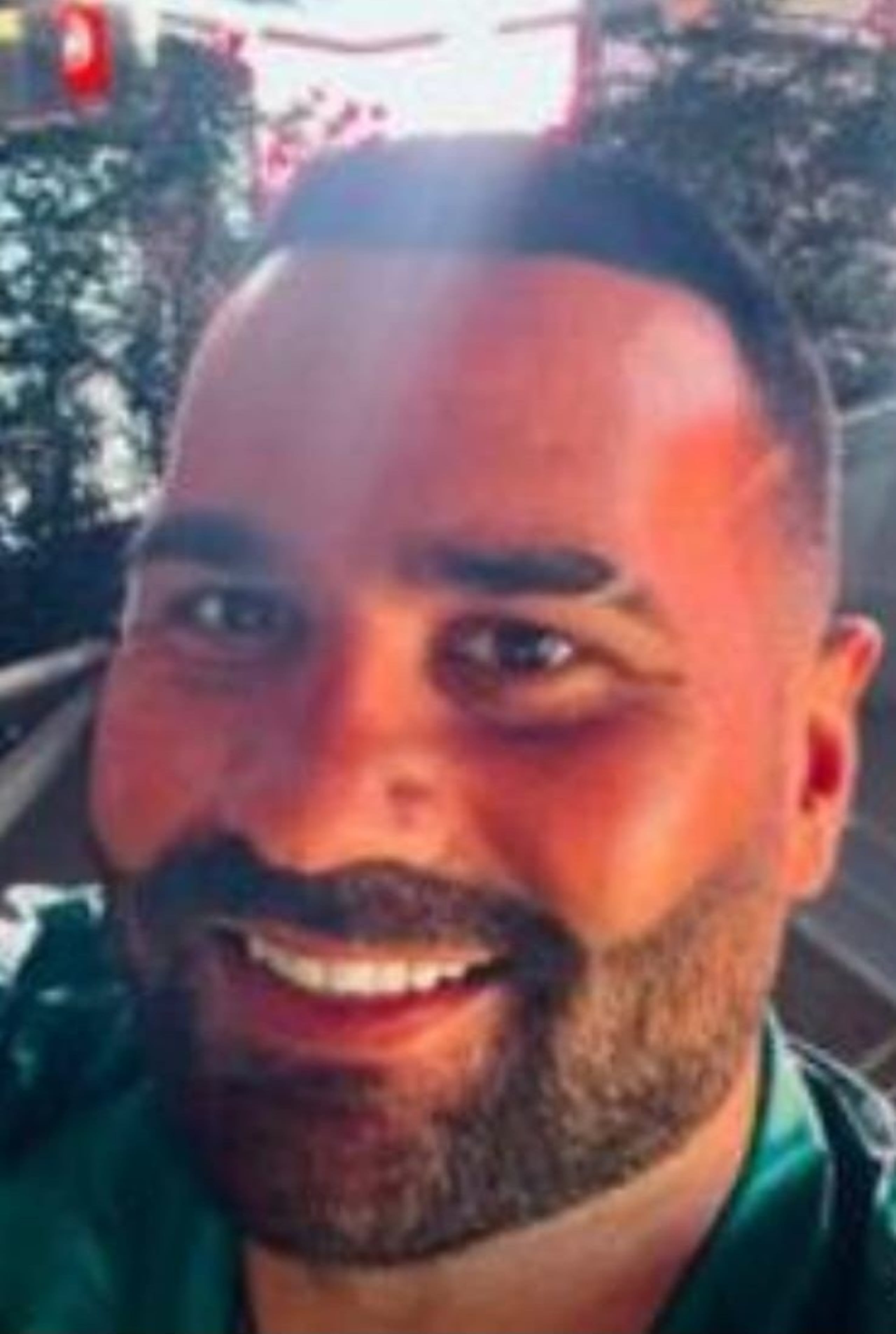 Contra Pedro A. Rivera Cartagena de 35 años, pesa una orden de arresto por apropiación ilegal y fraude, con una fianza de $20,000, por no pagar la totalidad de un transplante de cabello.