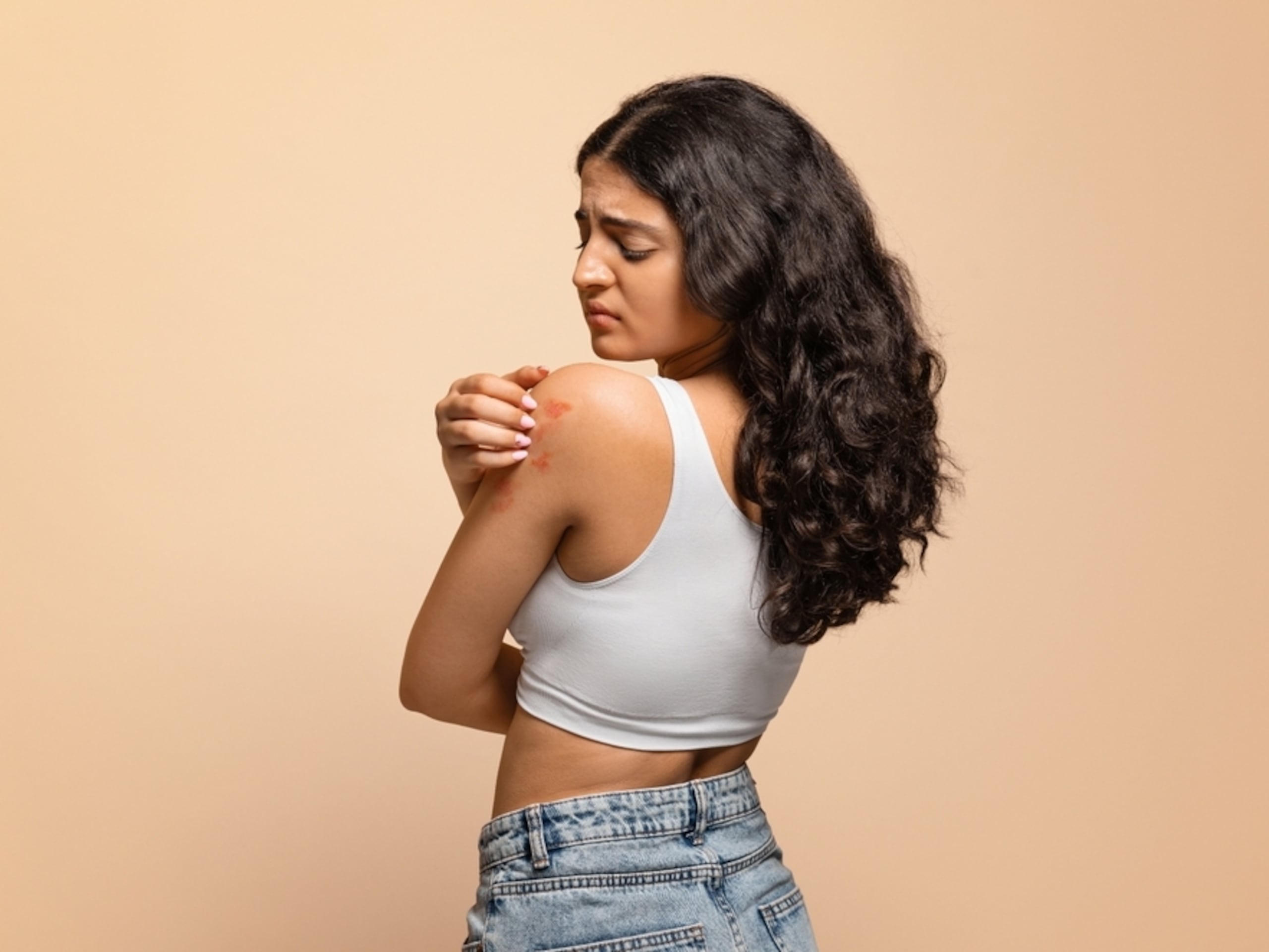 Según el Instituto Nacional de Alergias y Enfermedades Infecciosas, la causa exacta de la dermatitis atópica no se conoce, pero se cree que está relacionada con una combinación de factores genéticos, disfunciones inmunitarias y elementos del entorno, como el clima, los productos químicos o el estrés.