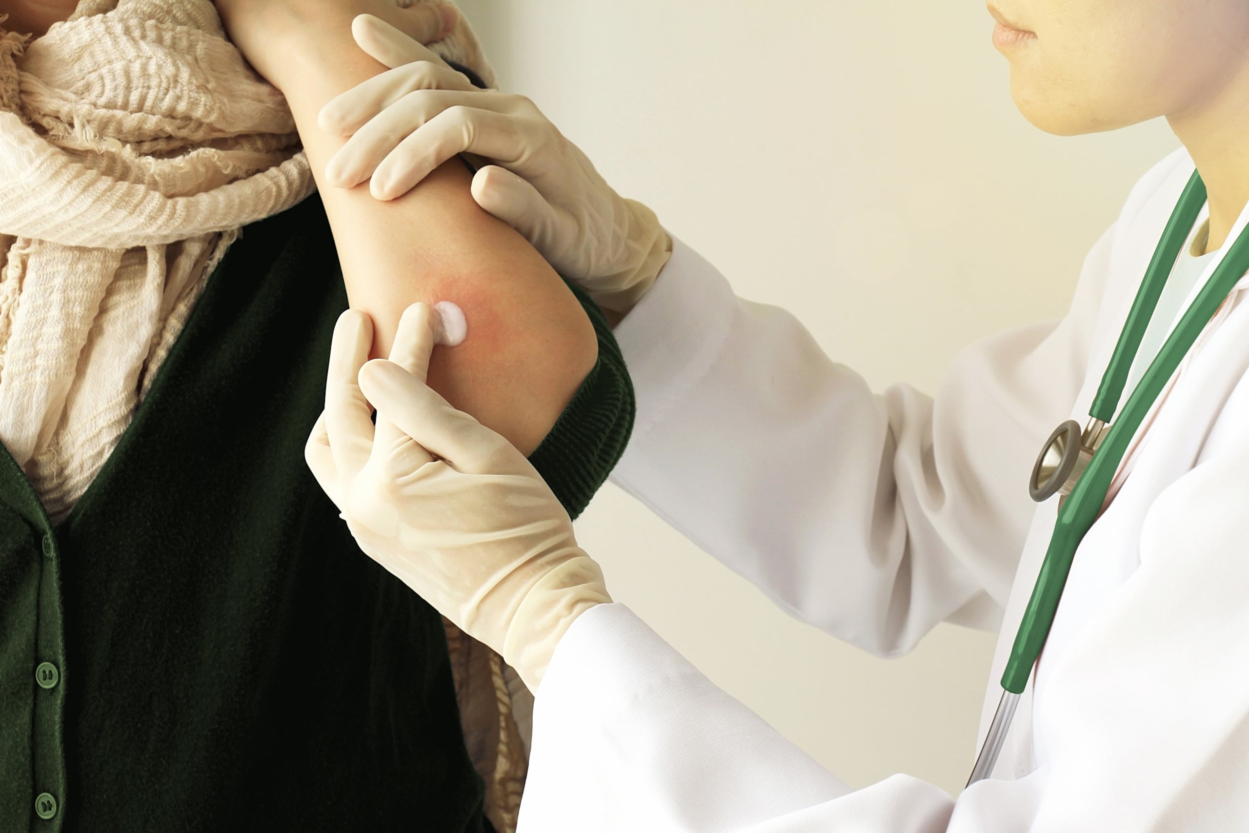 Aunque la psoriasis no es contagiosa, puede impactar la calidad de vida por síntomas como placas rojas, descamación, picor o ardor, que suelen ser visibles y, a veces, dolorosos. El seguimiento médico es primordial.