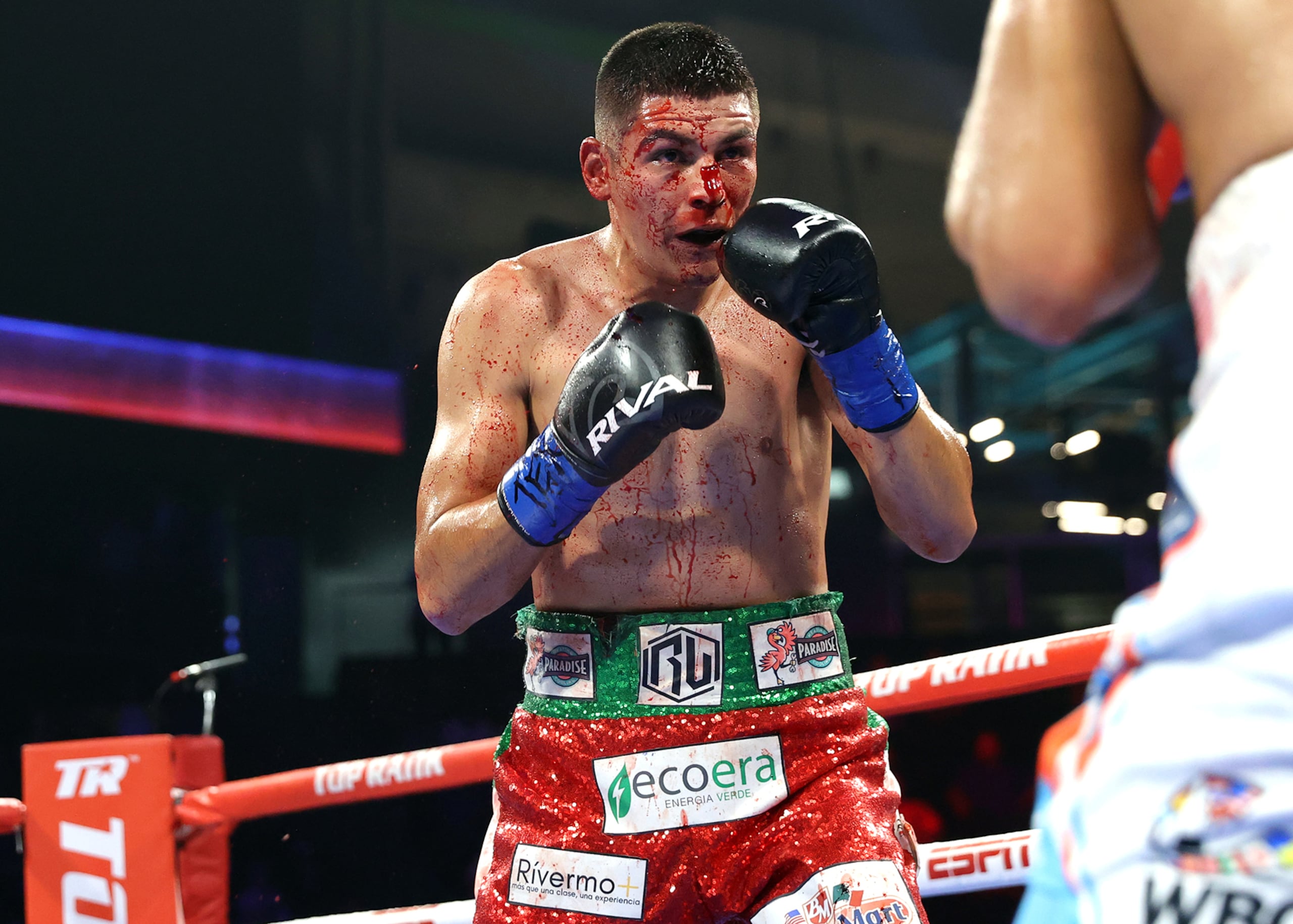 Roberto Valenzuela sufrió una cortadura en la nariz que provocó la intervención del referí.