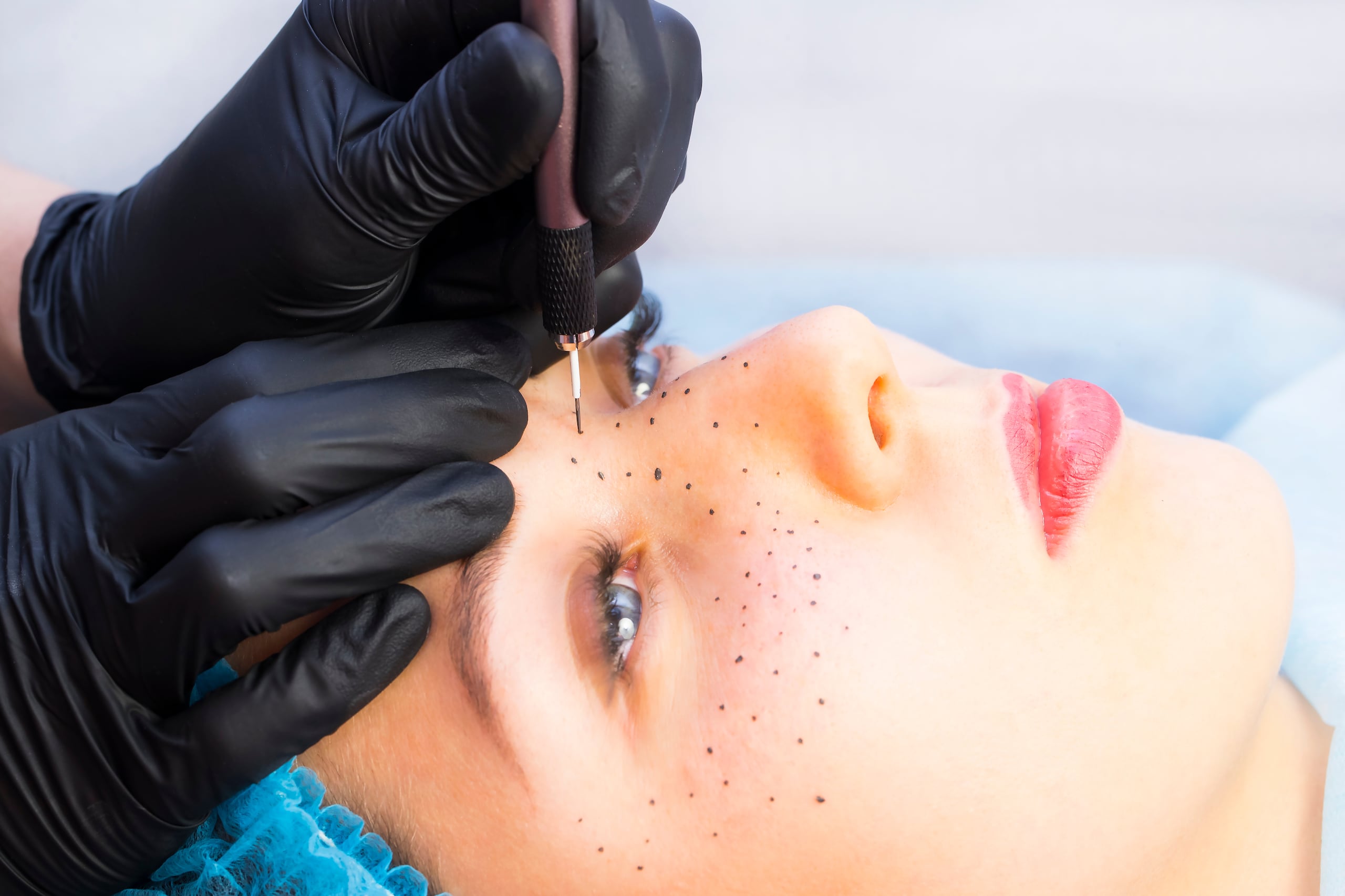 Usando una aguja fina y pigmentos semipermanentes, el artista tatúa las pecas en la piel en un proceso que puede durar entre 30 minutos y una hora, dependiendo de la cantidad de pecas que se deseen.