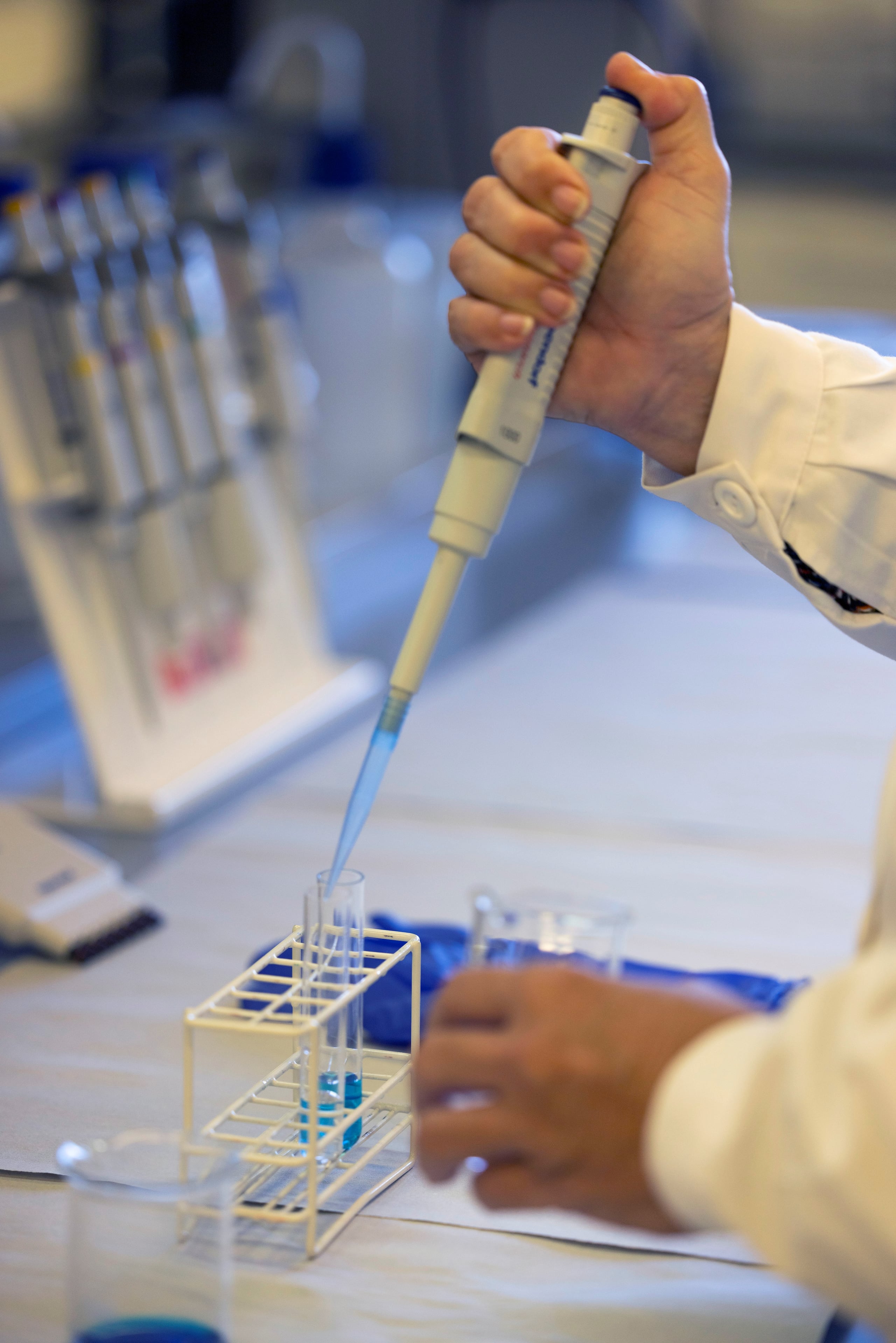 El nuevo estudio muestra que, cuando el sistema inmunitario combate el virus de Epstein-Barr, ciertas células T —que normalmente atacan al virus— también pueden reaccionar y atacar a una proteína del cerebro, la anoctamina-2 (ANO2). Archivo/EFE/Cati Cladera