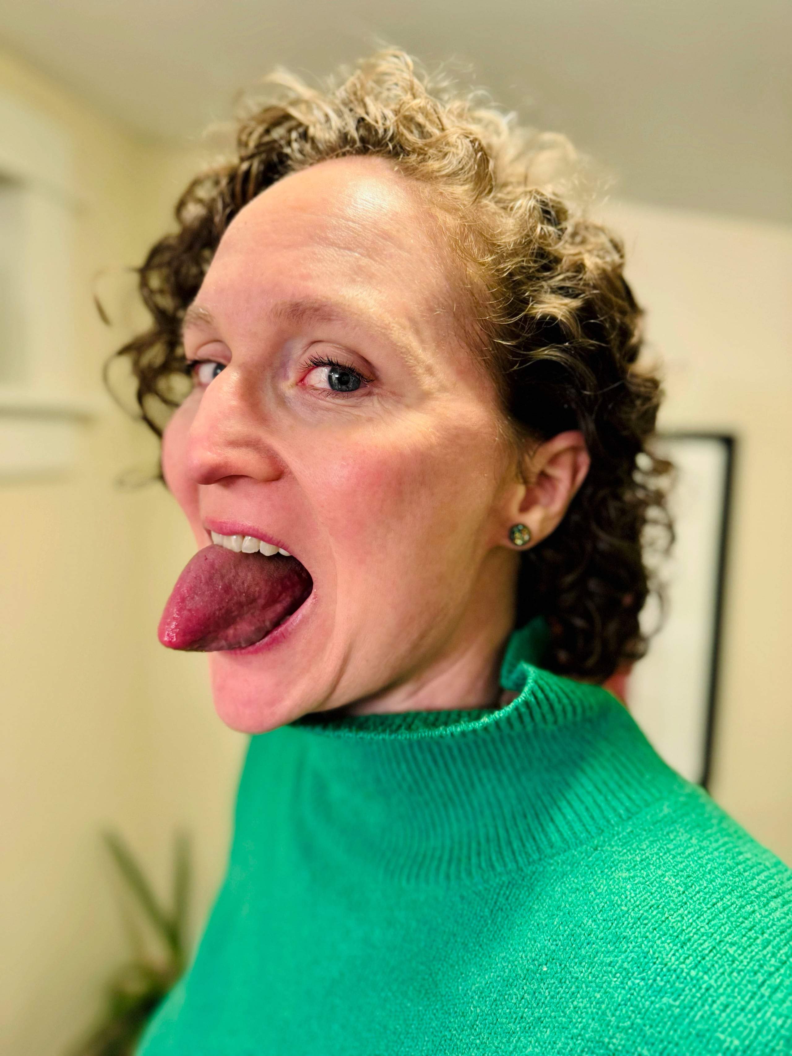 Jenny tiene que flexionar la lengua para medirla porque “si mi lengua fuera siempre tan grande, no creo que pudiera hablar”.