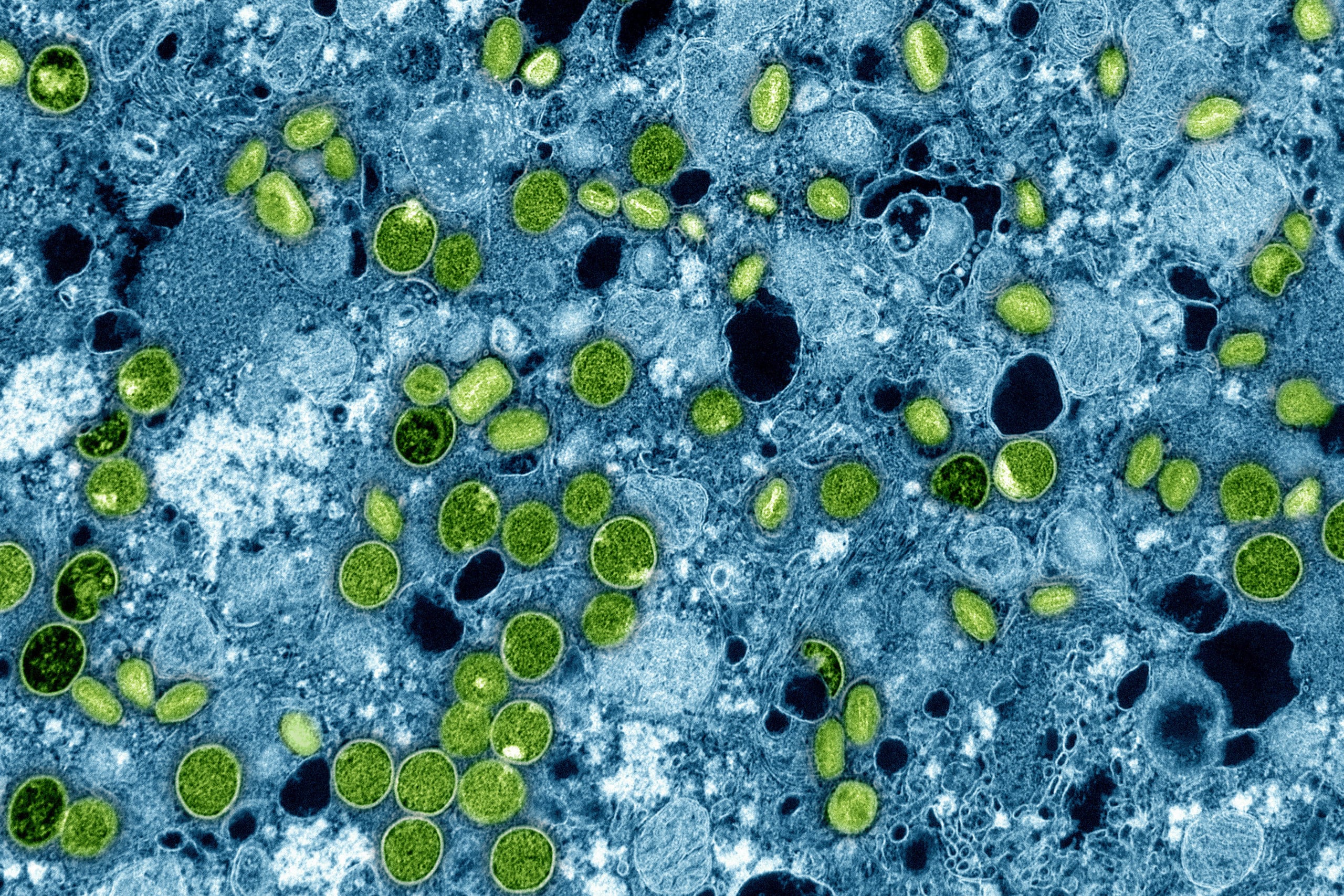 Esta imagen coloreada de microscopio electrónico proporcionada por el Instituto Nacional de Alergias y Enfermedades Infecciosas en 2024 muestra partículas del virus de la viruela, de color verde, encontradas dentro de células cultivadas infectadas, de color azul. (NIAID vía AP, Archivo)