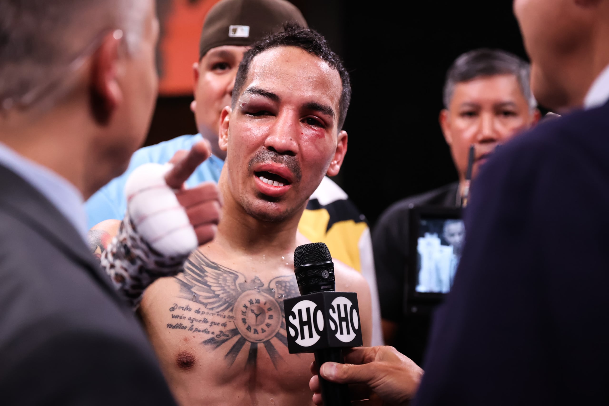 Manny Rodríguez terminó con el ojo cerrado. (Showtime / Amanda Westcott)