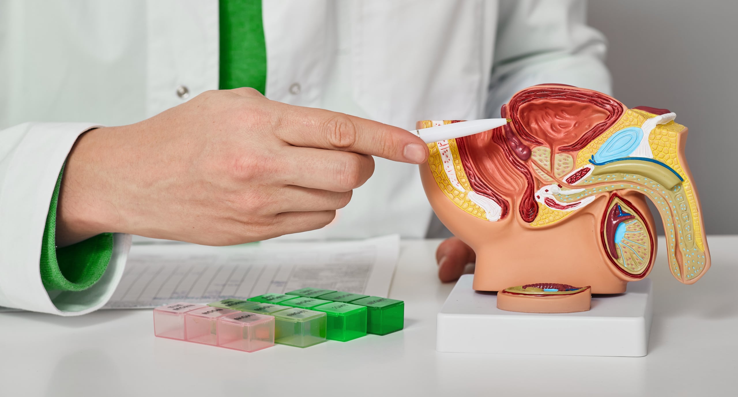 En sus primeras etapas, el cáncer de próstata no da señales claras, por lo que la evaluación del urólogo es crucial.