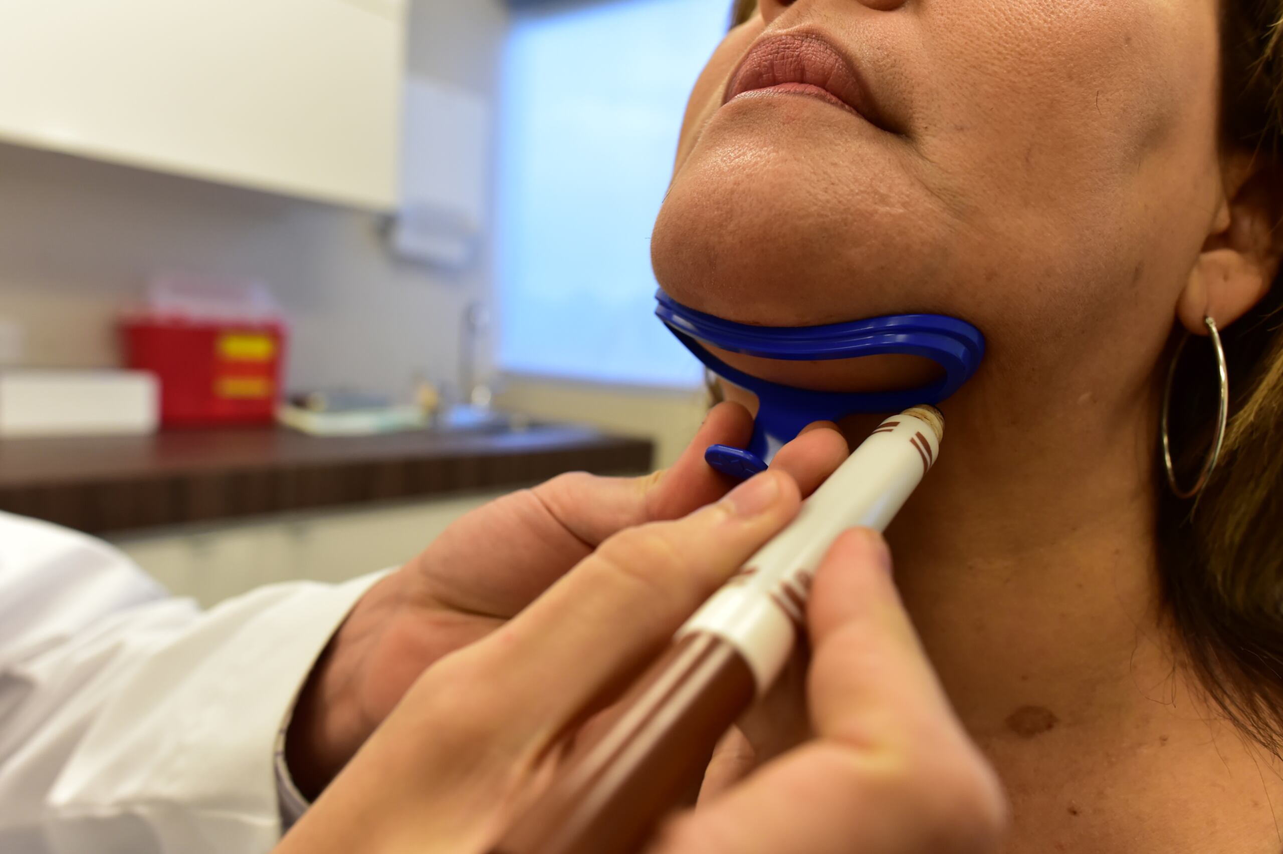 2015/11/11 SAN JUAN PUERTO RICO. NUEVO APLICADOR COOLMINI DE COOLSCULPTING QUE ELIMINA LA GRASA DE LA PAPADA SIN CIRUGIAS NI INYECCIONES.PASO 1 MARCAR EL AREA QUE SE QUIERE TRABAJAR EN ESTE CASO LA PAPADA.DR DERICK I MARRERO CIRUJANO PLASTICO
LUI.ALCALADELOLMO@GFRMEDIA.COM